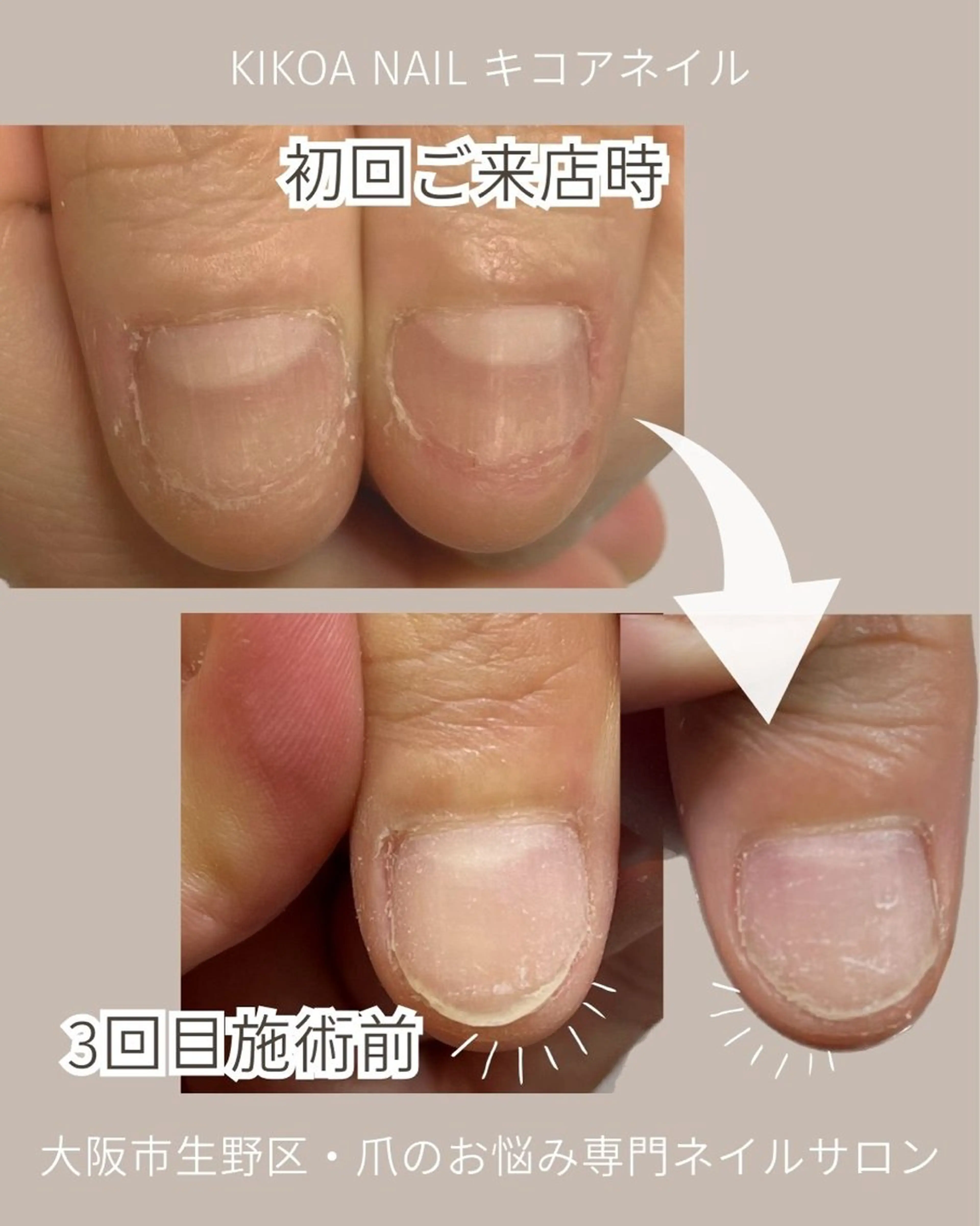 ネイル KIKOA NAIL キコアネイルのネイルデザイン