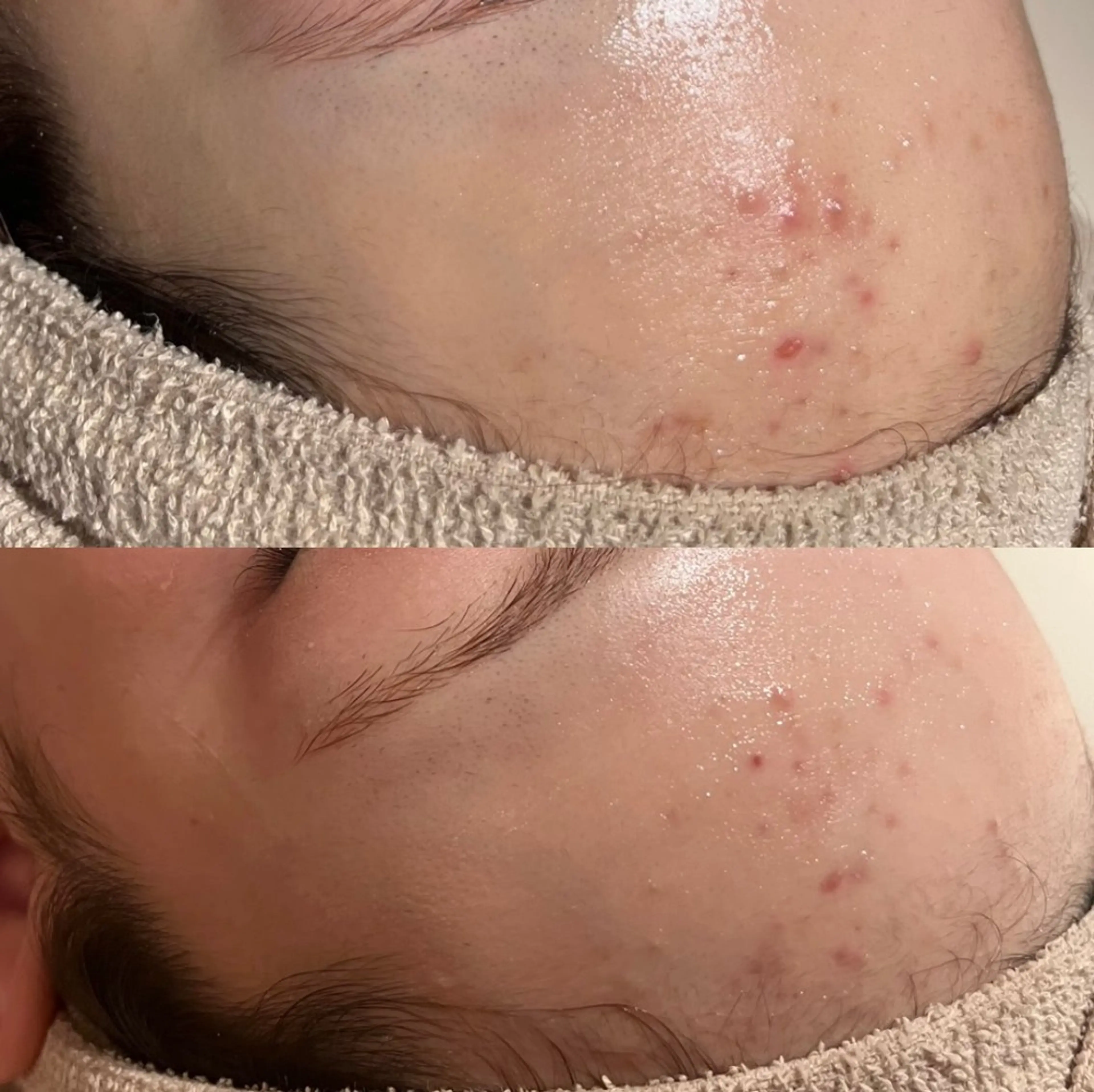 その他 for woman所属・森 美優のエステ・リラクイメージ