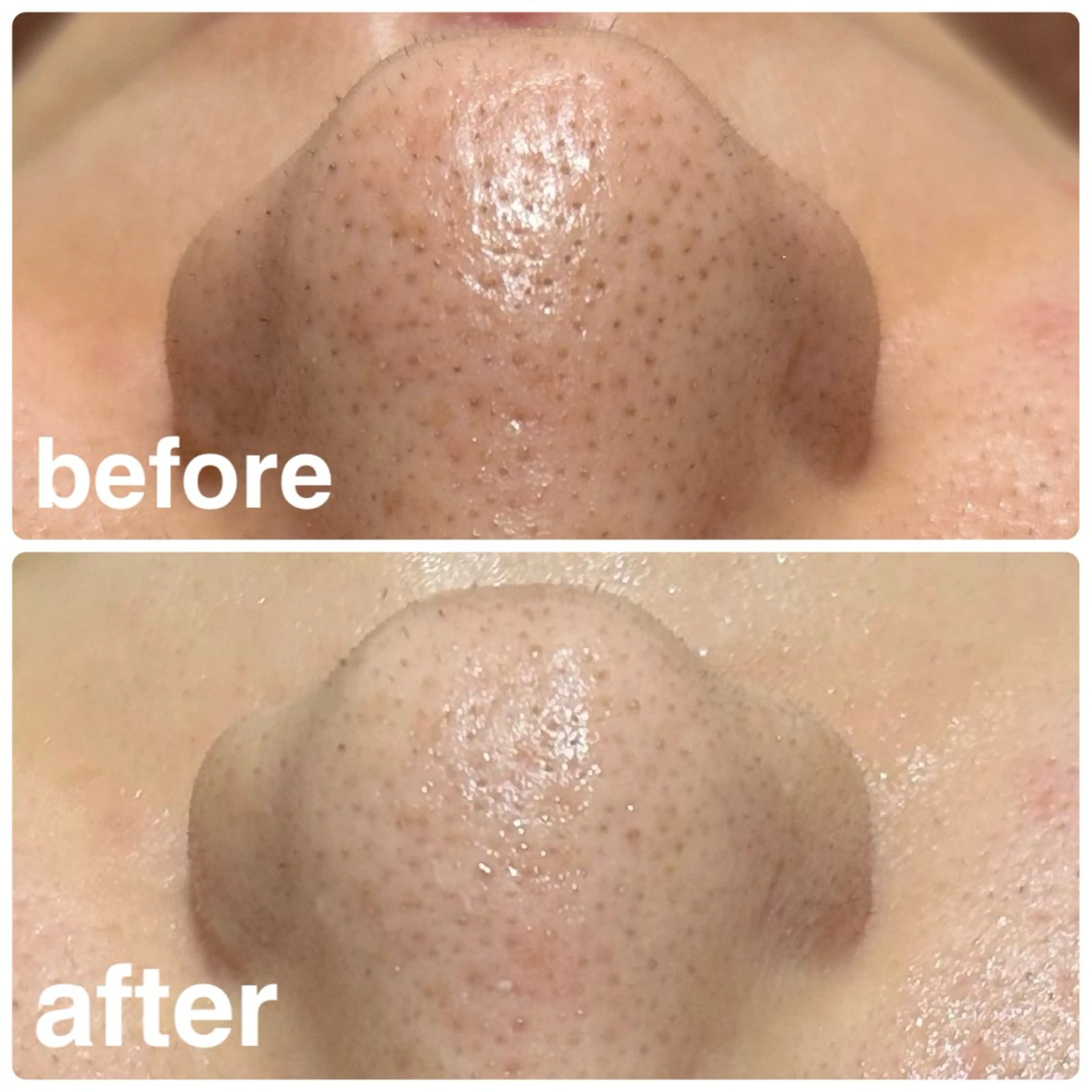 フェイシャルエステの写真