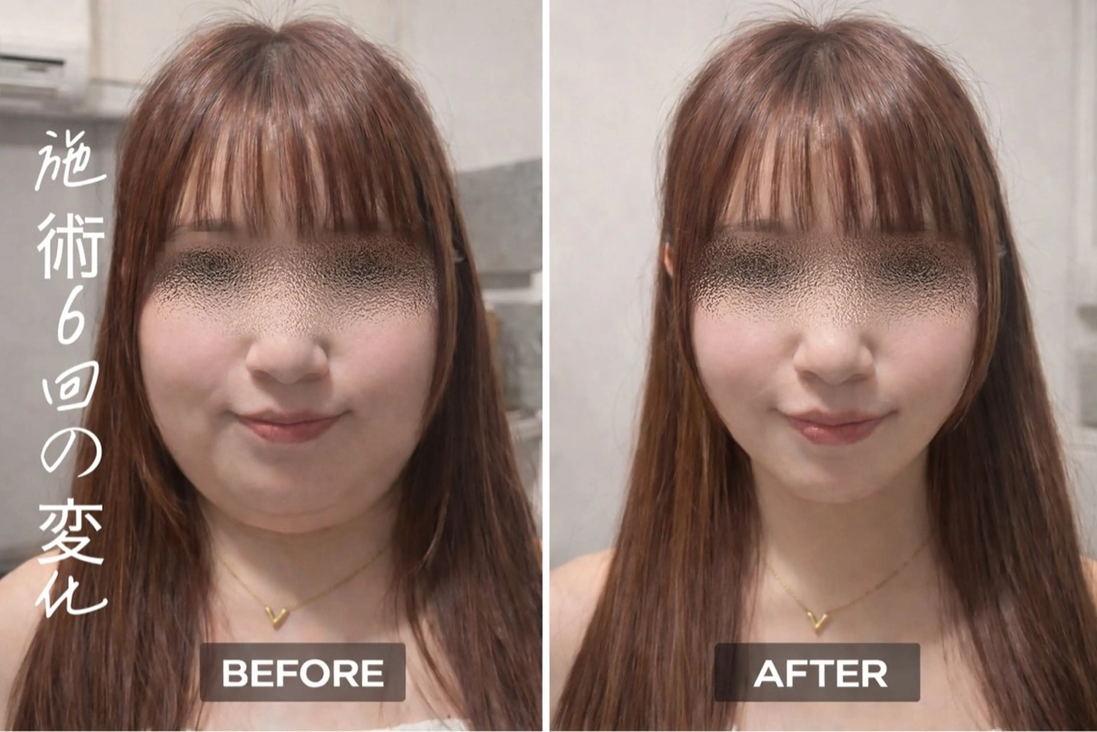 【歴13年】劇的小顔 D rマジックタッチのエステ・リラクイメージ