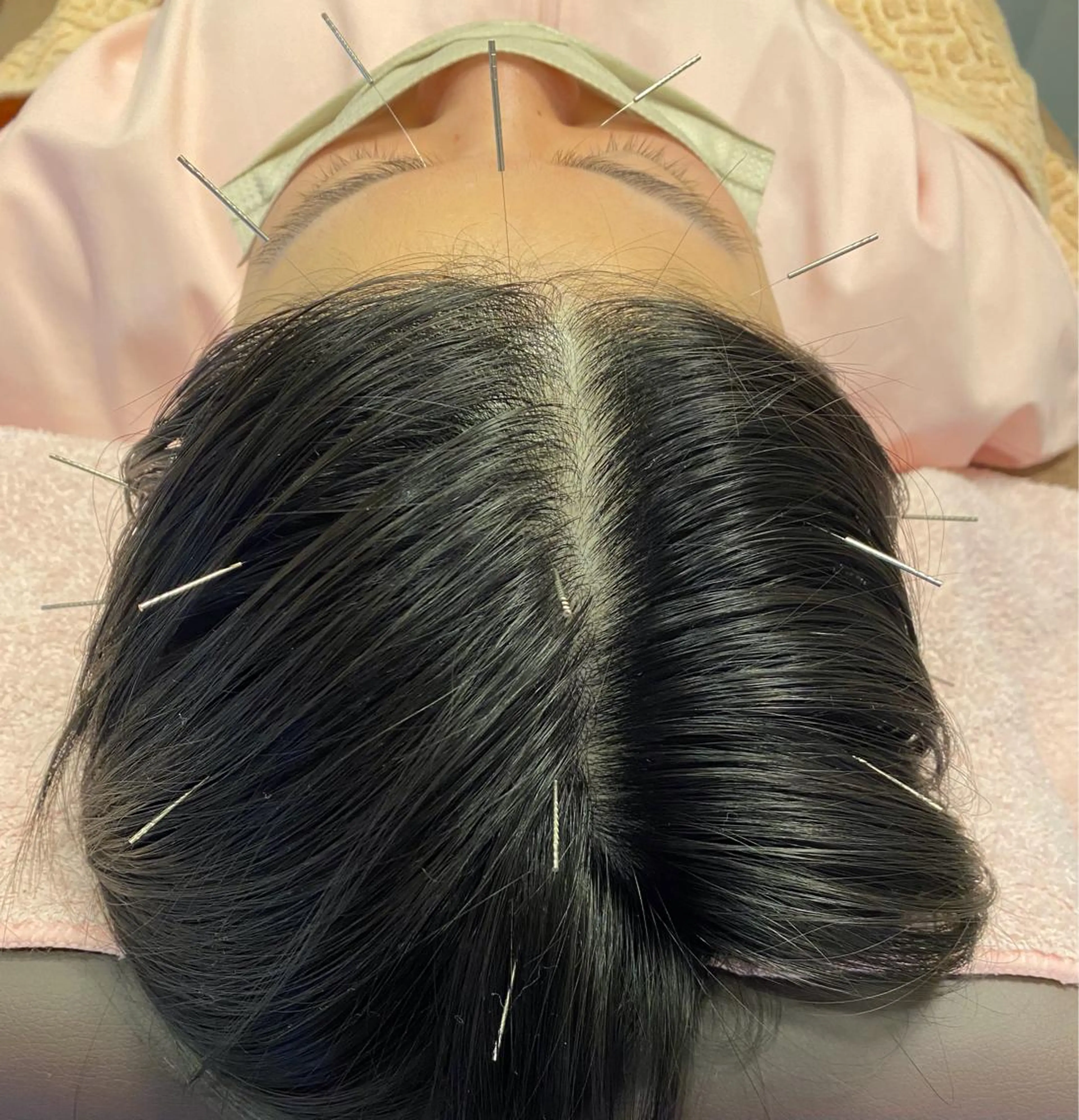 MOXA鍼灸院所属・MOXA鍼灸院 旧:鍼灸整体院Ranのエステ・リラクイメージ