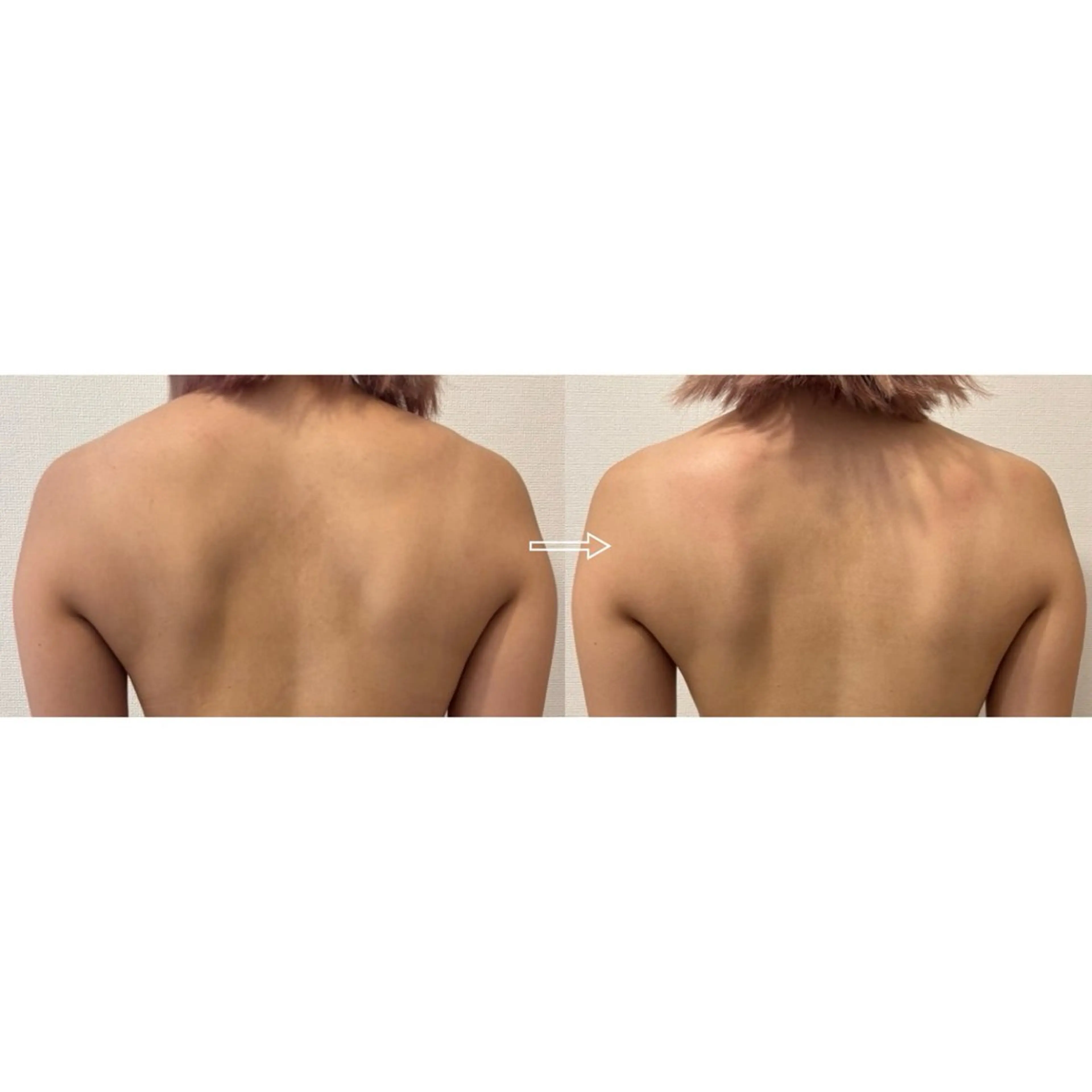 【ミニモ限定】美肌全身リンパマッサージ80分の写真