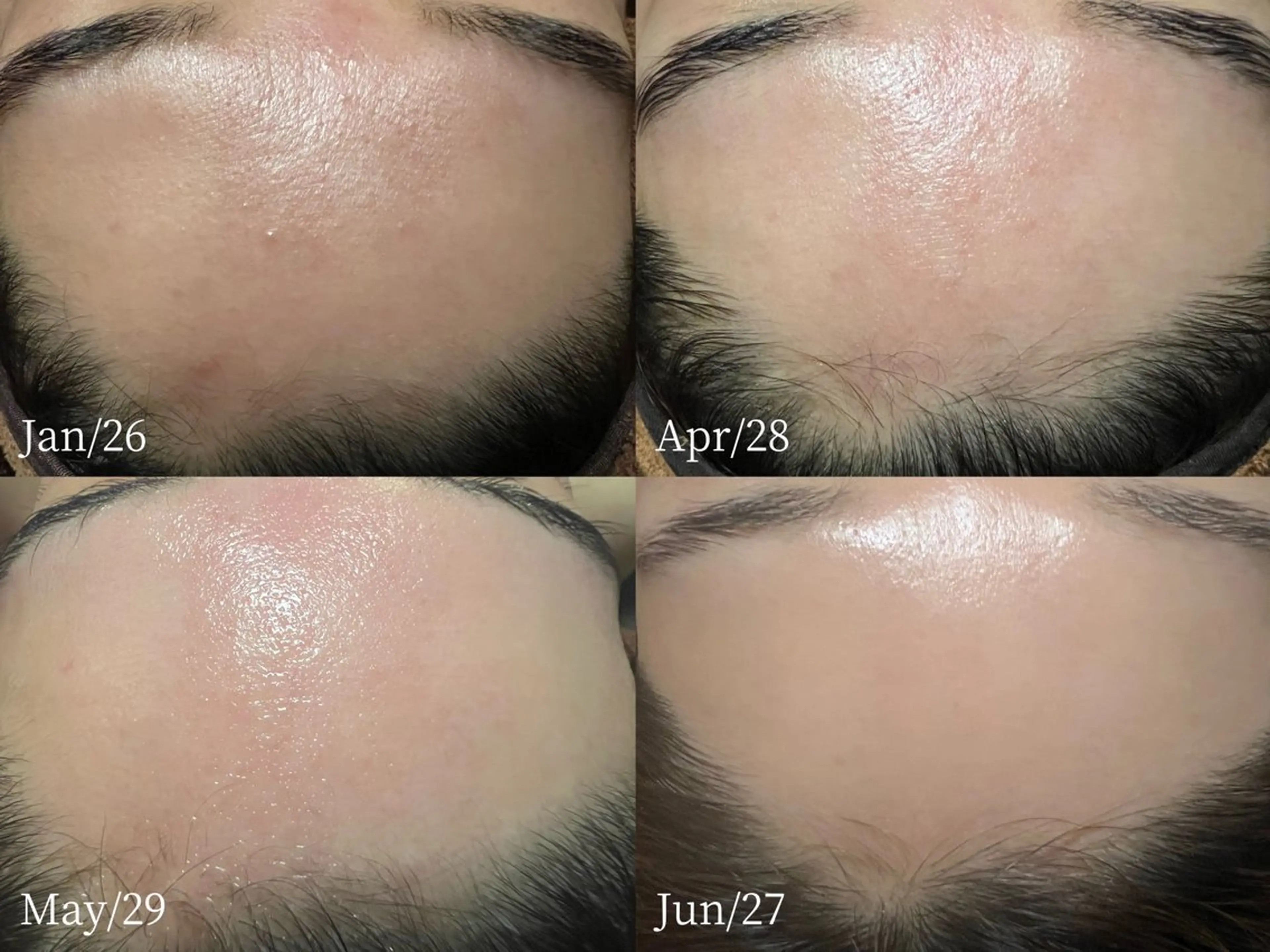 エステ リラク lymph care 'Welnəsのエステ・リラクイメージ