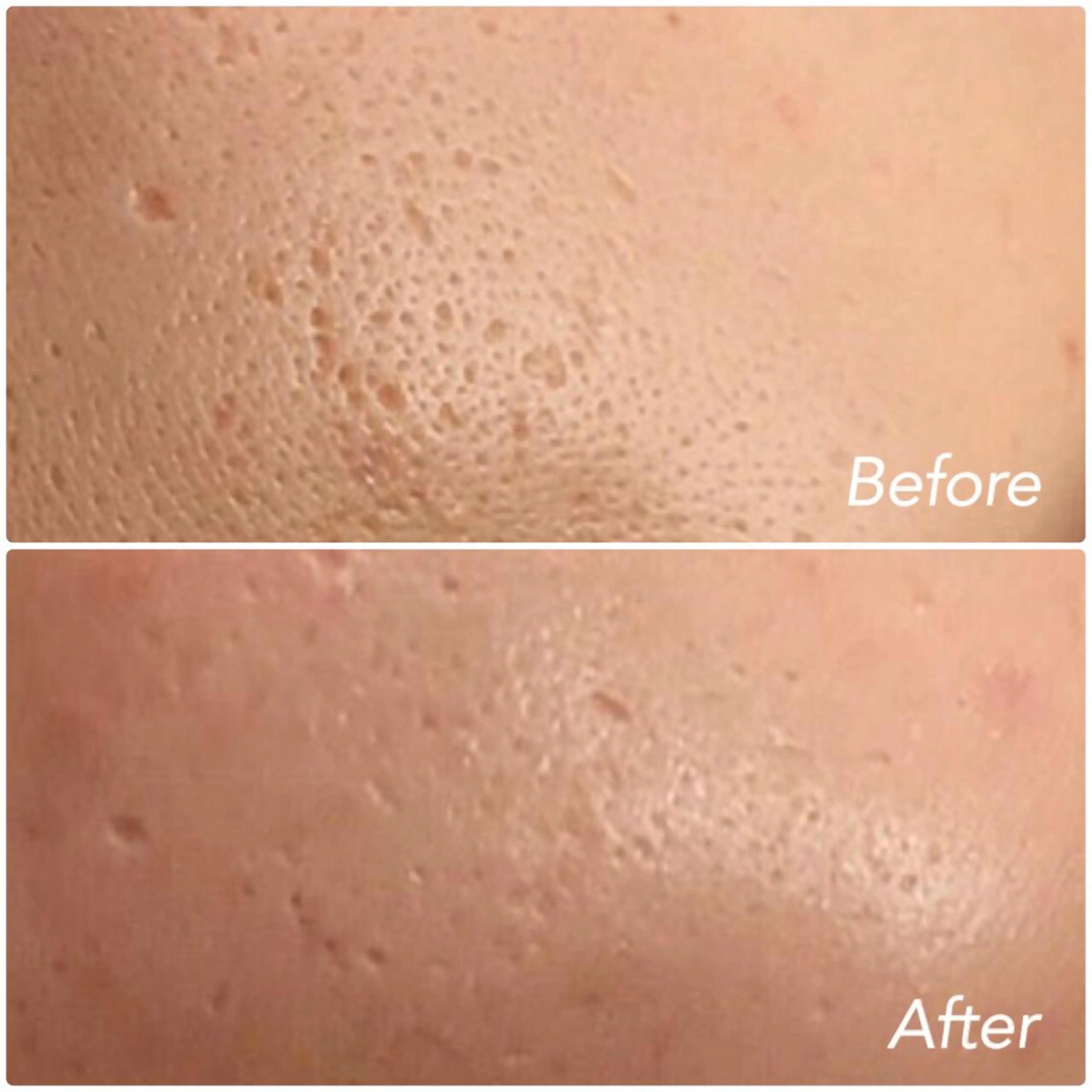 L’Beige レベージュのエステ・リラクイメージ