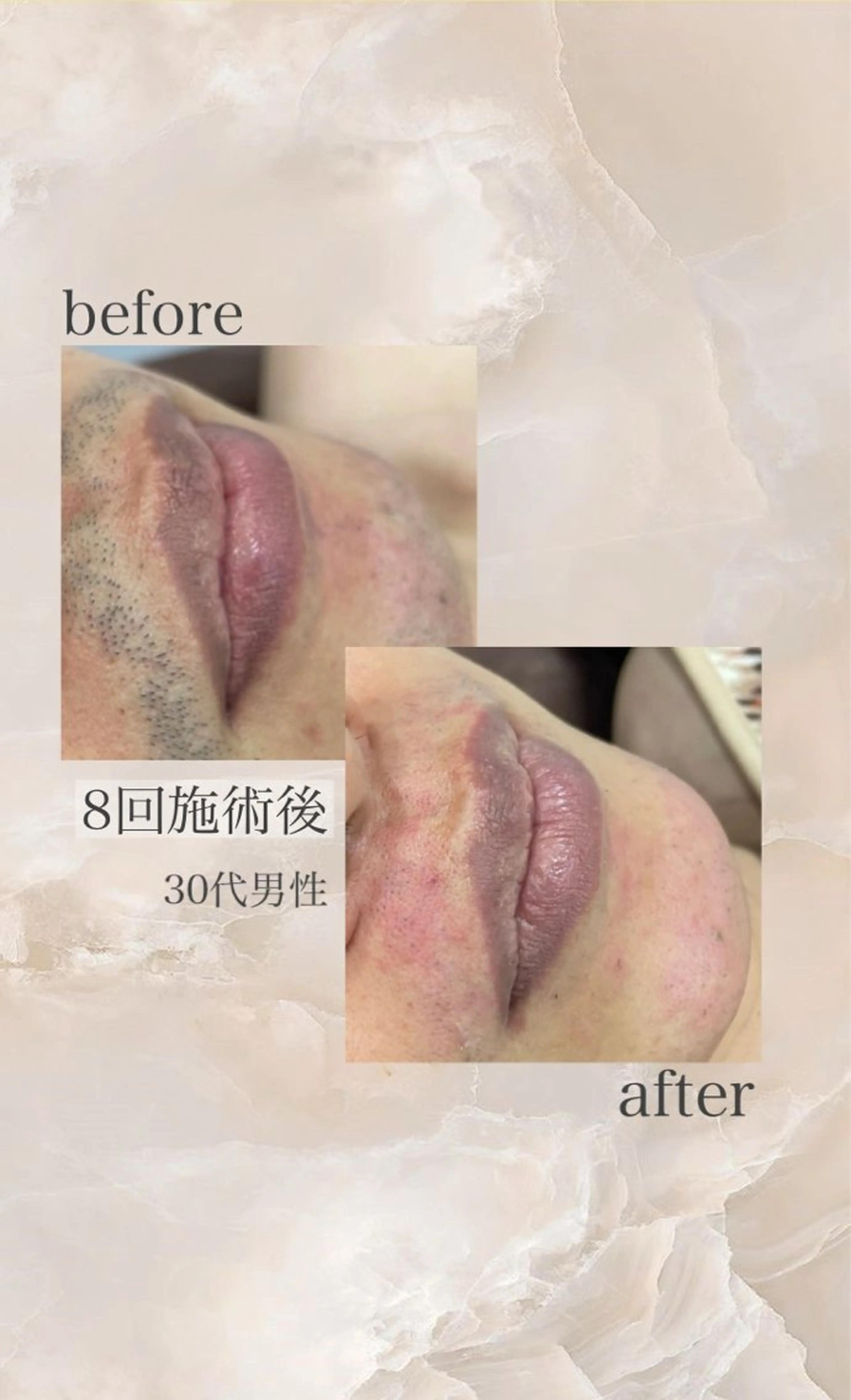 メンズ 脱毛 salon de cerm所属・CERM/心斎橋眉毛 /心斎橋HBLの眉毛・アイブロウイメージ