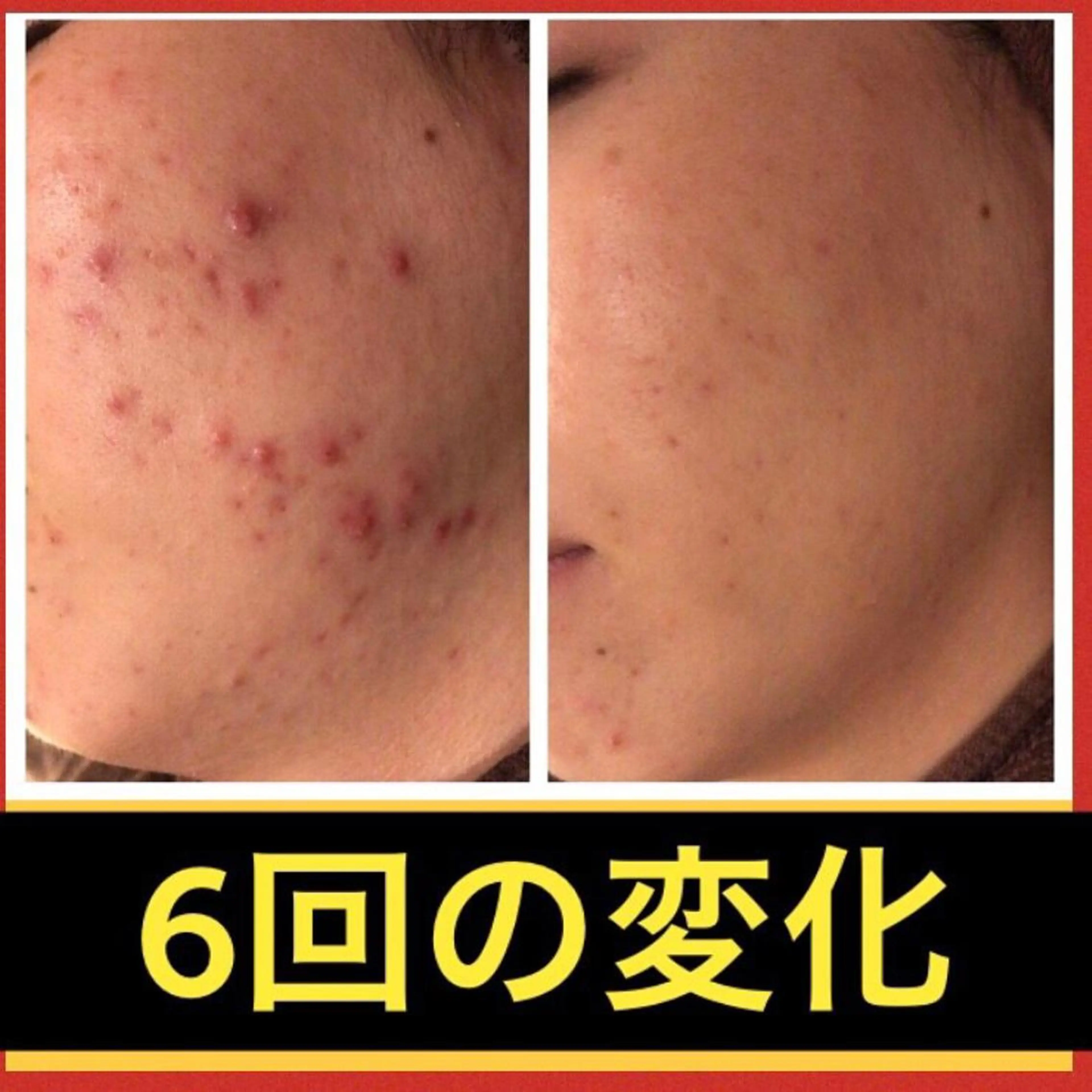 ミディアム カラー パーマ ヘアアレンジ メンズ キッズ ネイル マツエク・マツパ エステ リラク ニキビ・肌質改善専門 ♡人生が変わるサロンのエステ・リラクイメージ