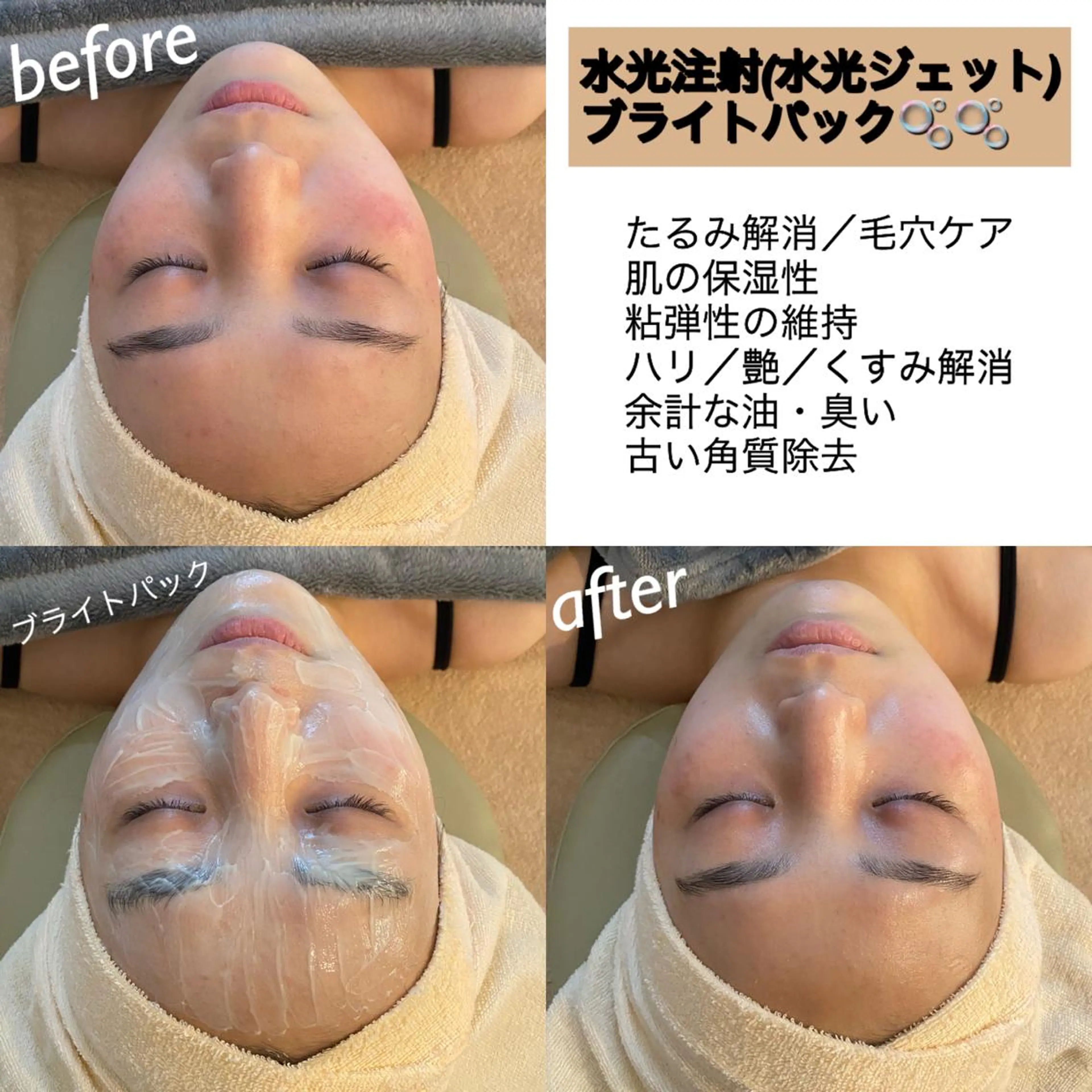 うなじ脱毛/美肌脱毛 LABELのエステ・リラクイメージ