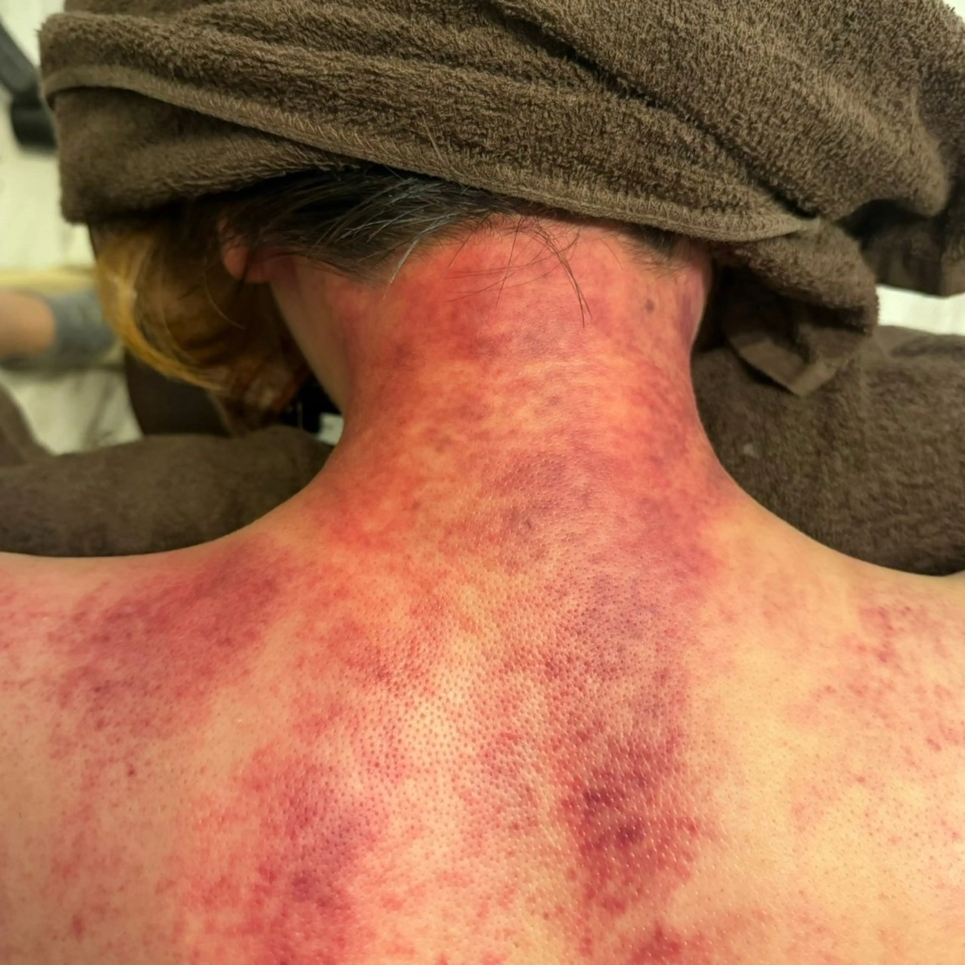 その他 セルフエステエンリケ明石大久保店所属・夕希リンパ&痩身& 脱毛&毛穴ケアのエステ・リラクイメージ