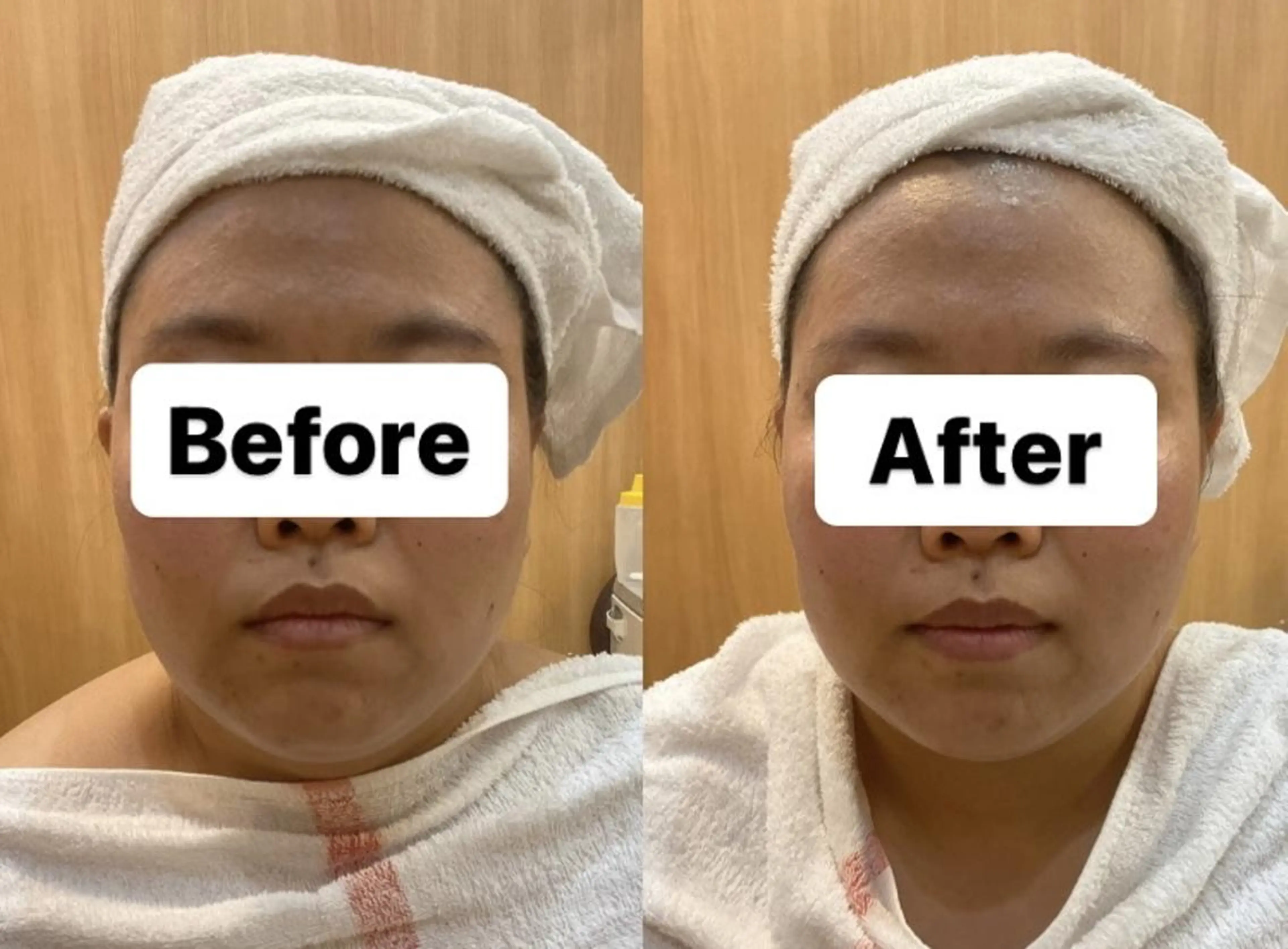 OPREA 千種店のエステ・リラクイメージ