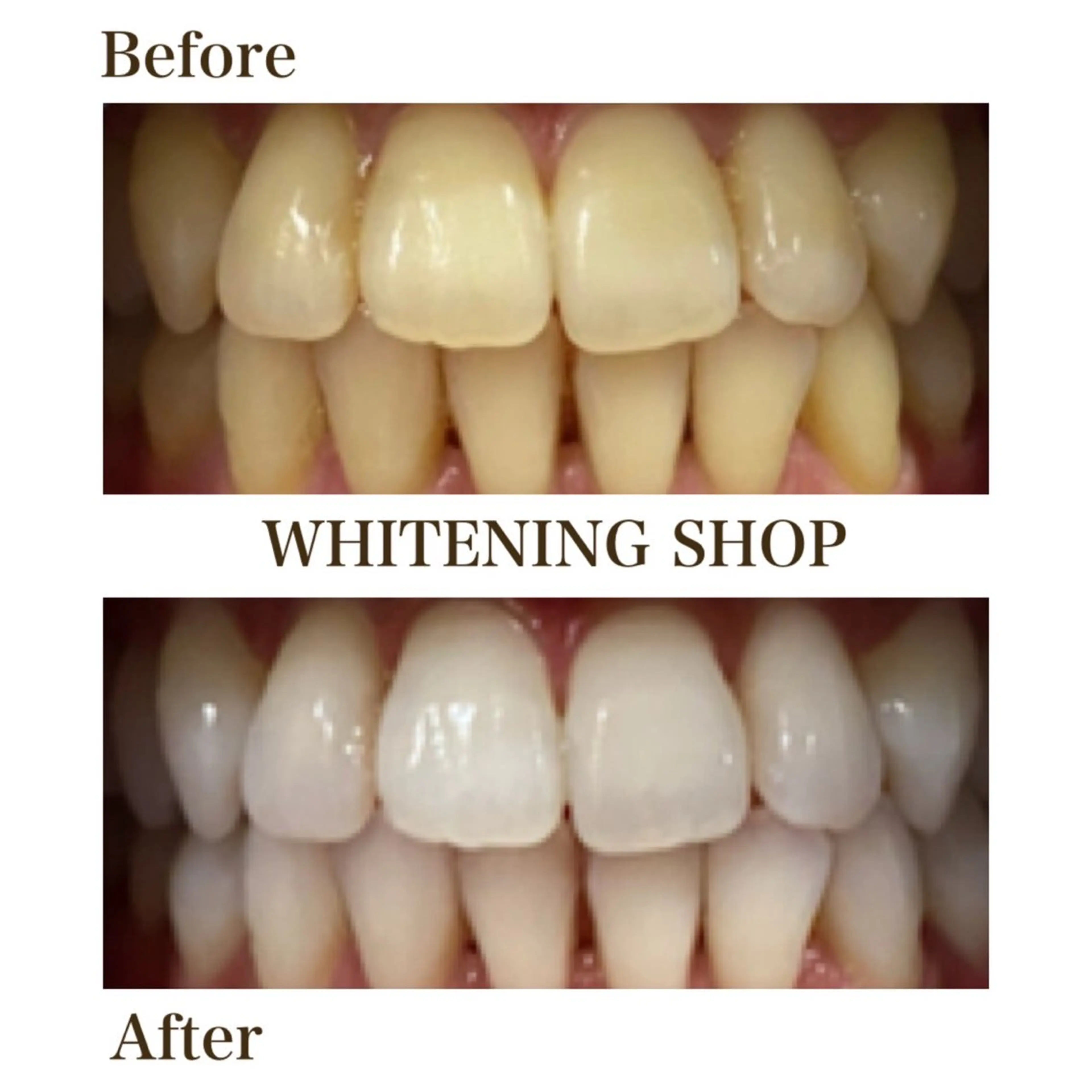 メンズ キッズ エステ リラク ホワイトニング ショップ川越店のエステ・リラクイメージ