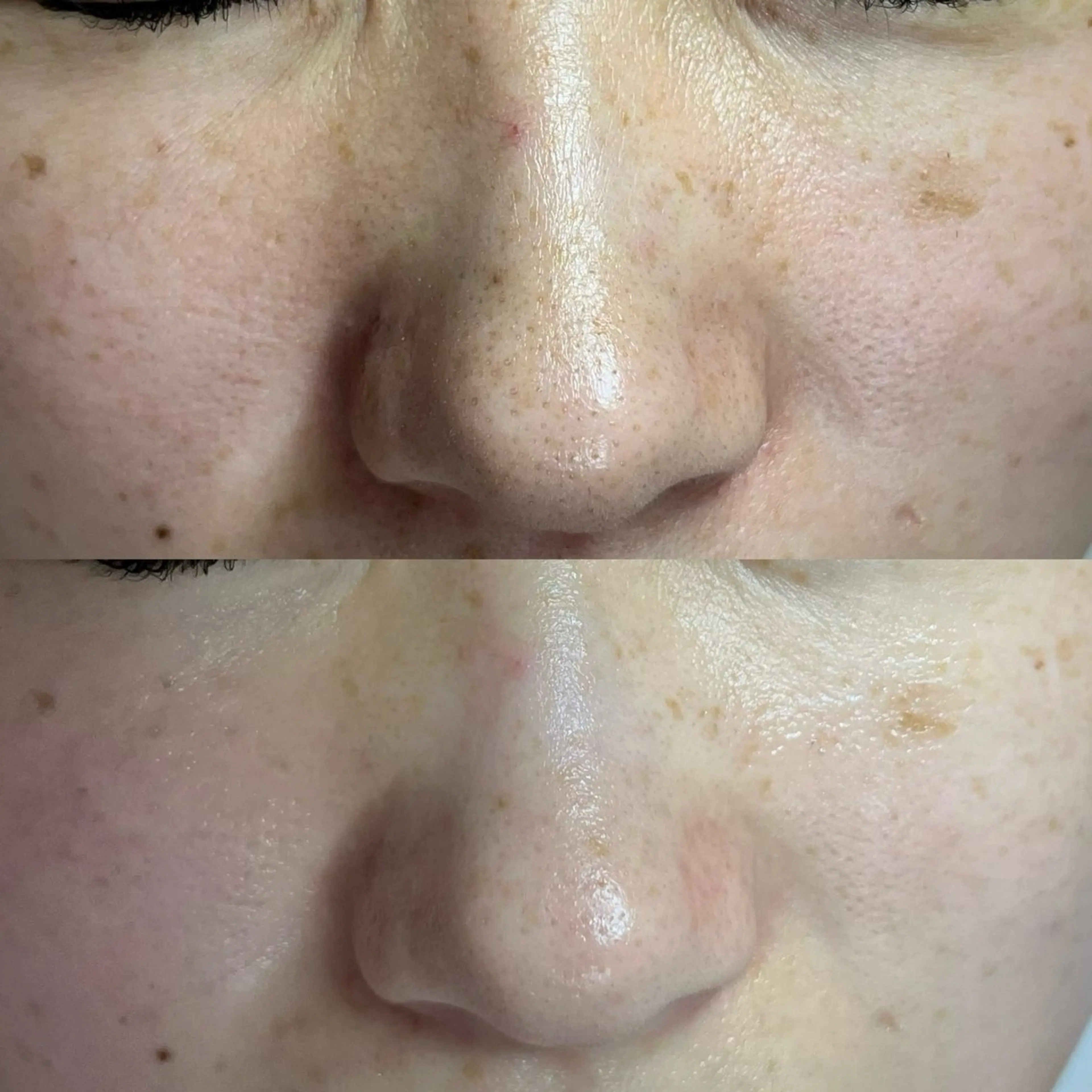 毛穴ケア・ヘッドスパサロンSHINY(シャイニー)所属・毛穴ケア・ヘッドスパ サロンSHINYのエステ・リラクイメージ