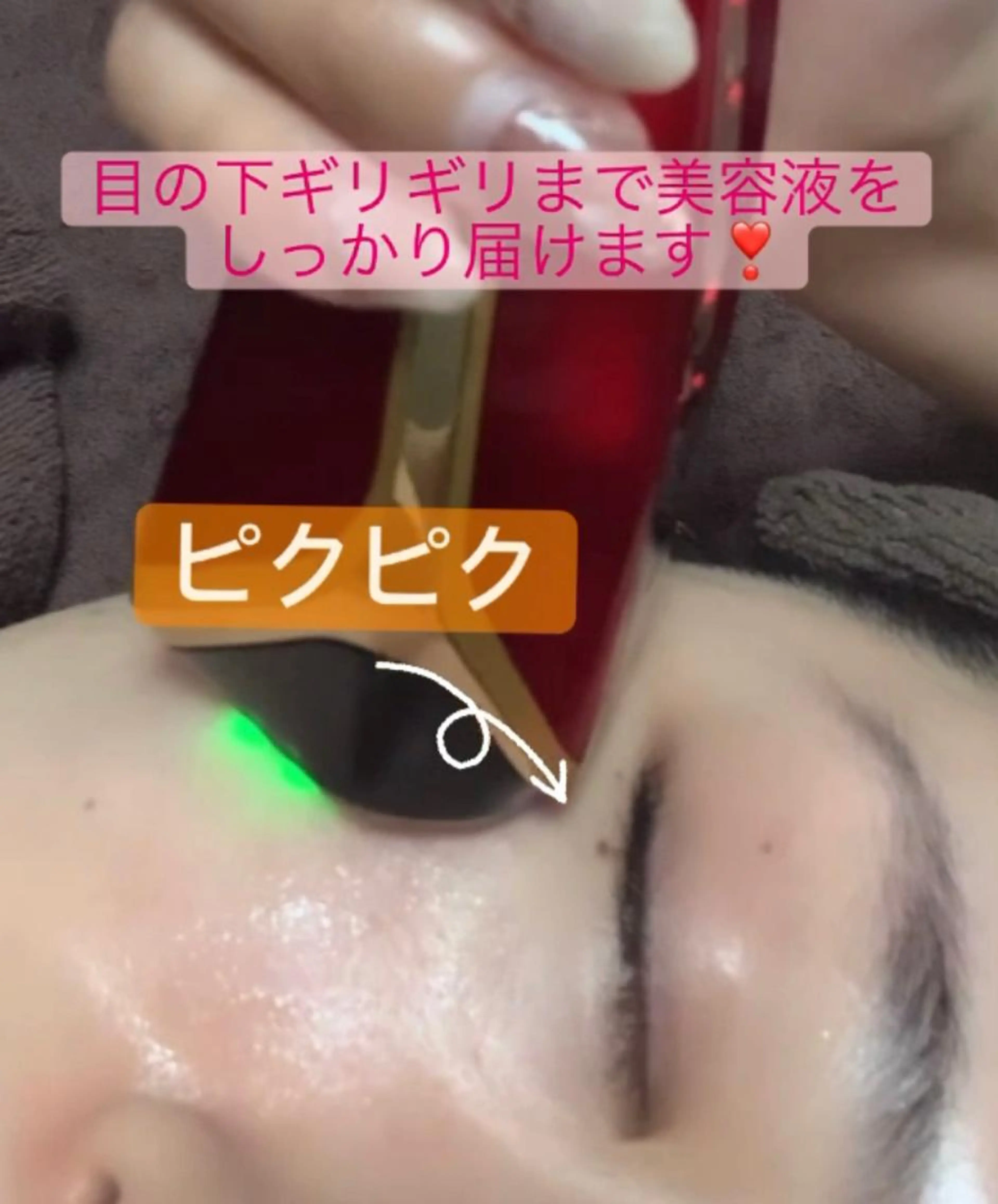 ハリ艶肌コース　10人限定価格✨残り2名《超音波洗浄/美容液導入/ヒト幹細胞培養液使用》の写真