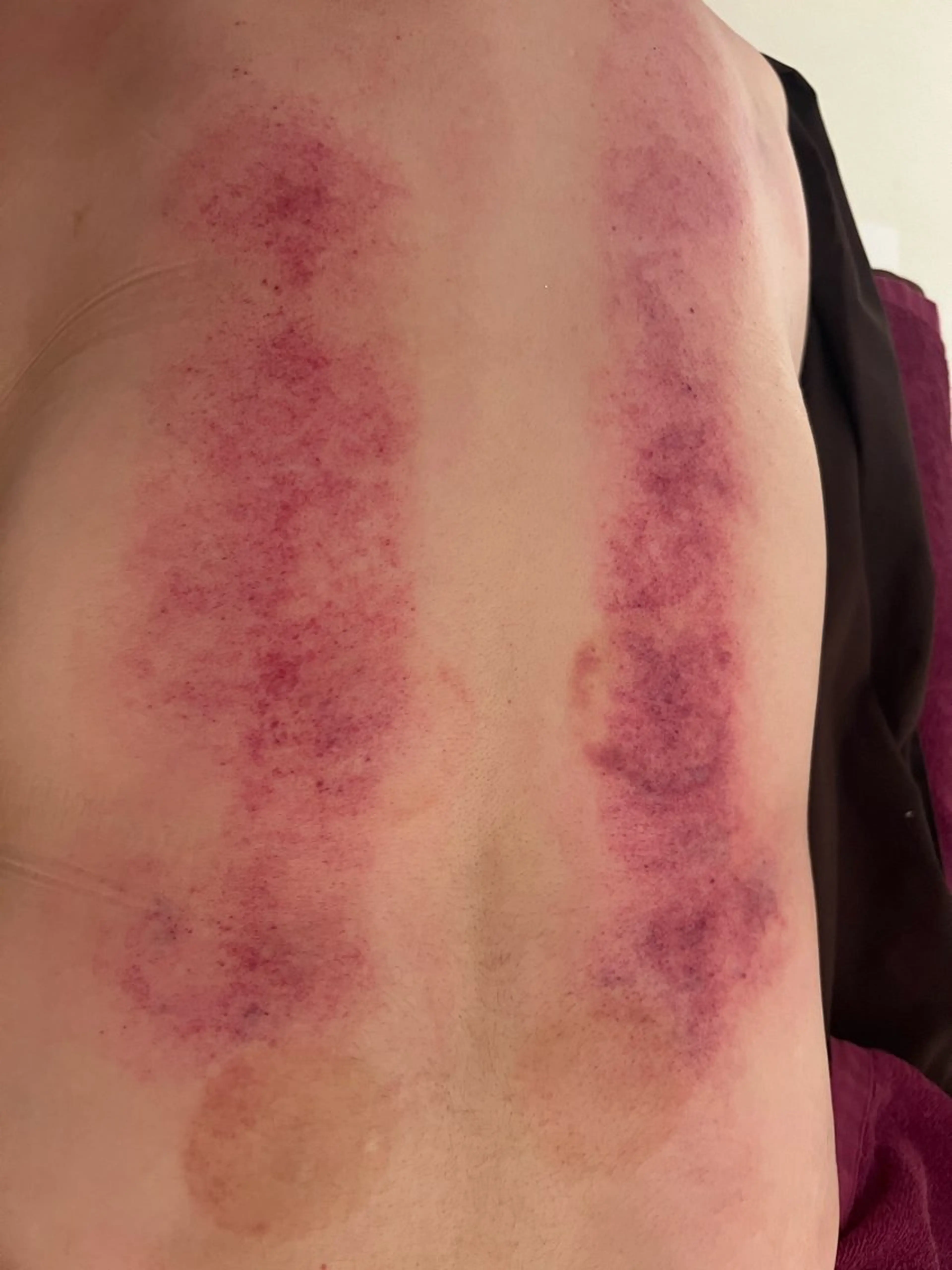 鍼処　木蓮所属・小顔美肌クリエーター 鍼処木蓮のエステ・リラクイメージ