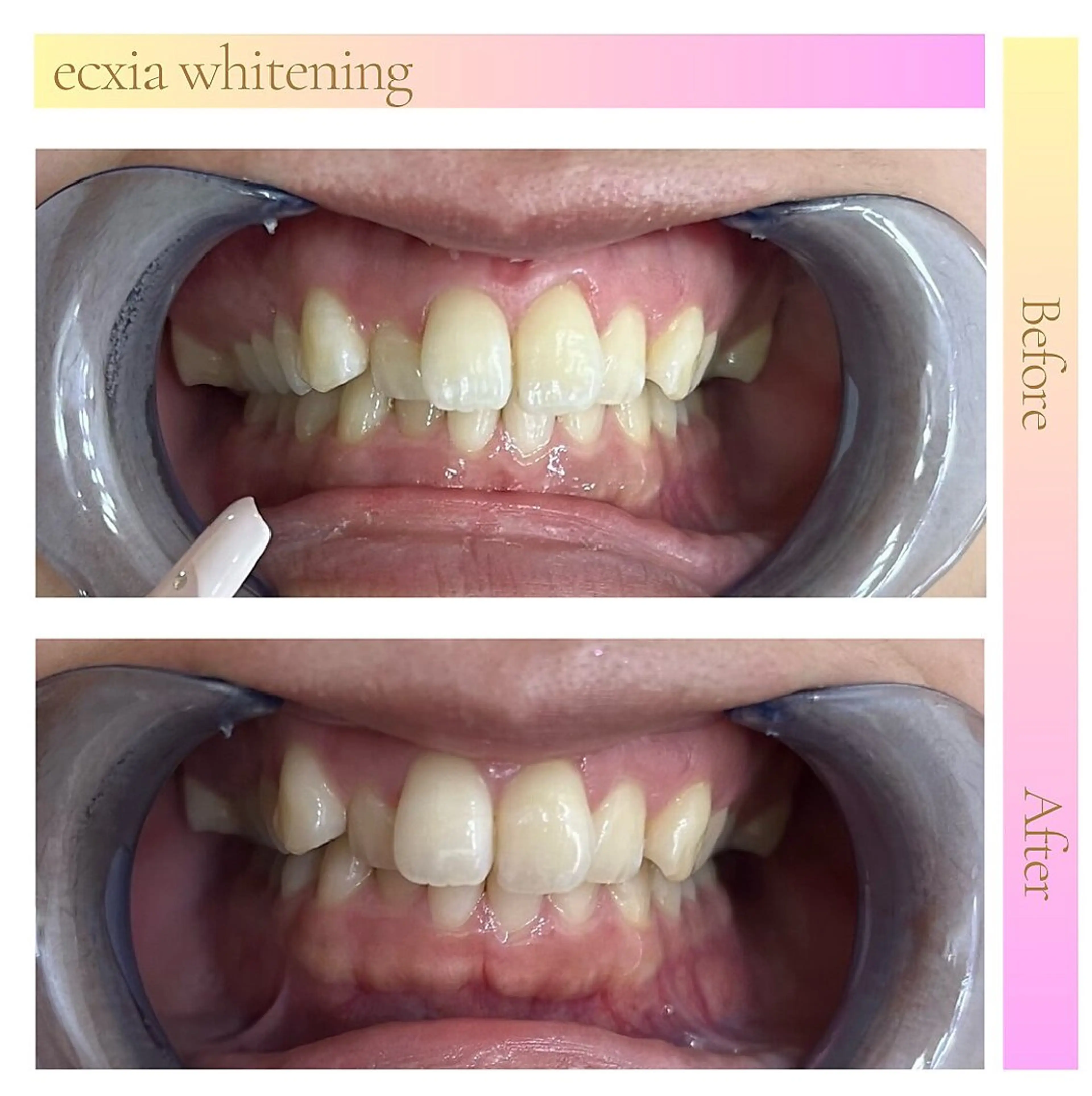 ecxia  white 　広島袋町店所属・セルフホワイトニング エクシア広島袋町店のその他イメージ