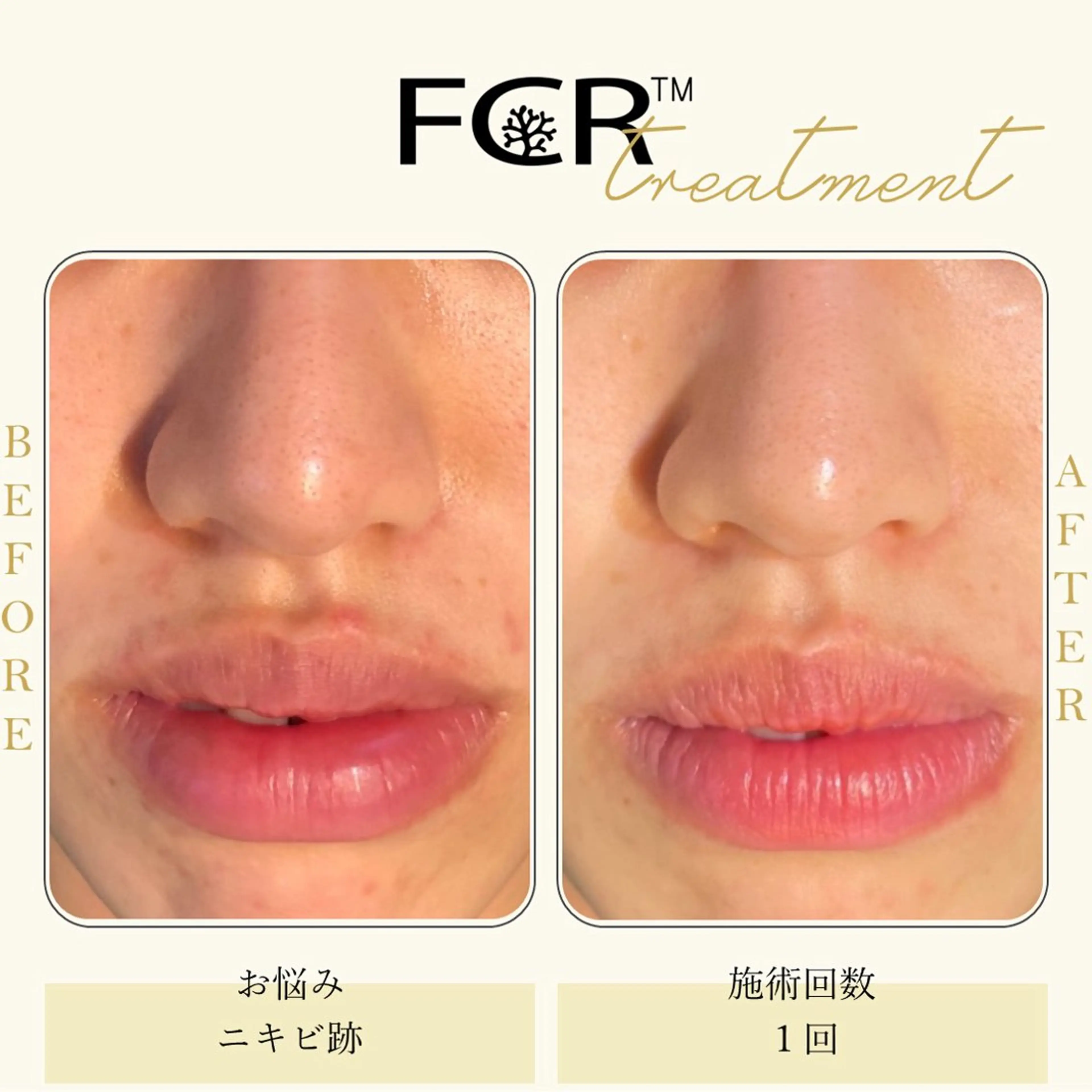 奥村 まよのエステ・リラクイメージ