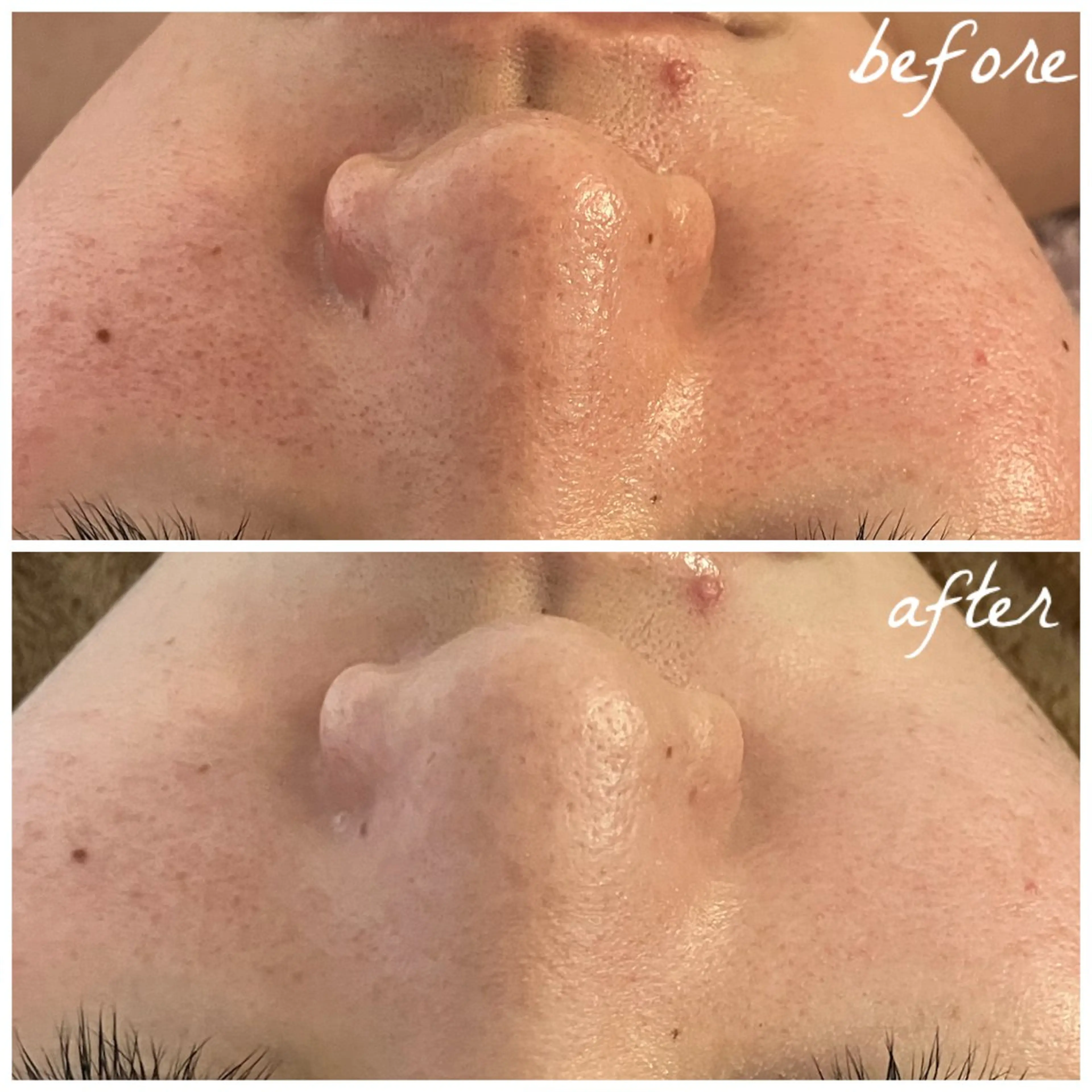 メンズ エステ メナード岐阜茜部 杉浦のエステ・リラクイメージ