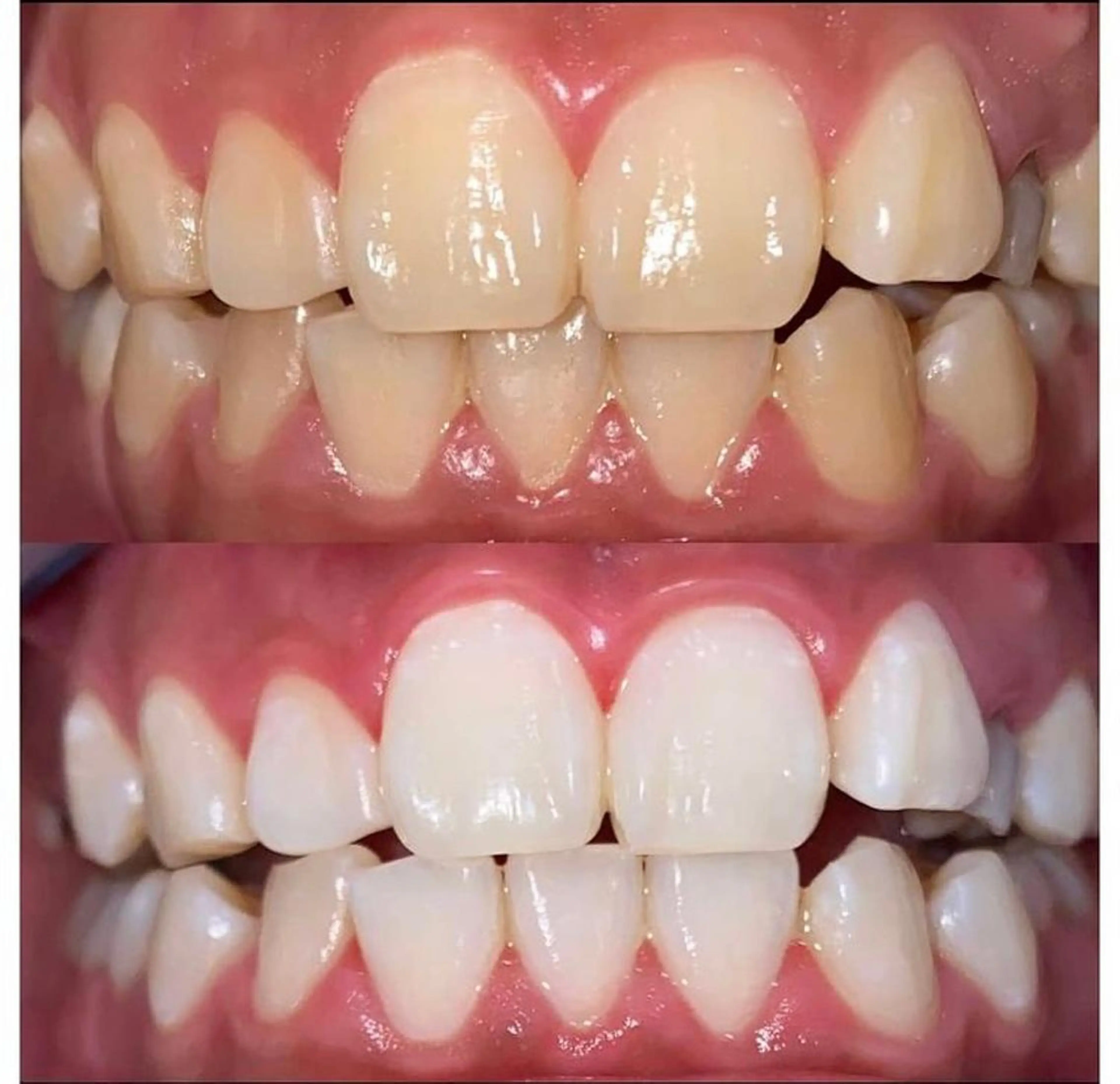 プラチナムビューティー柏所属・【歯科提携】柏ホワイ トニングスタイルのその他イメージ