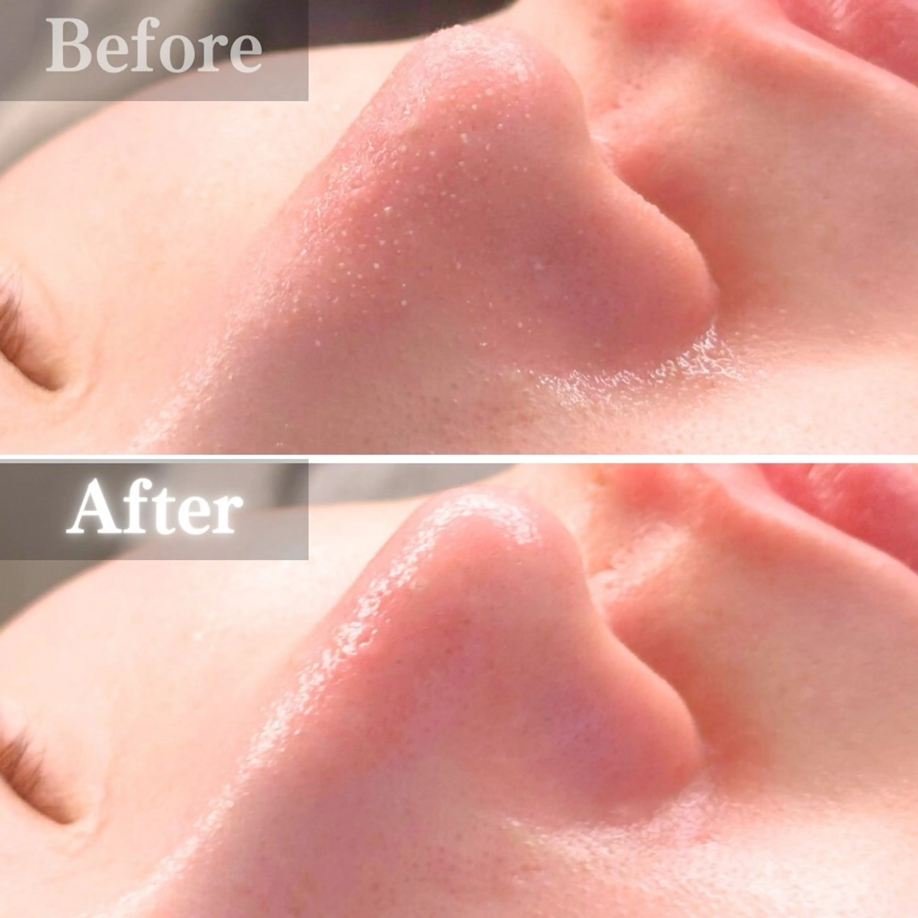 エステ 毛穴洗浄特化🫧 オオツカのエステ・リラクイメージ