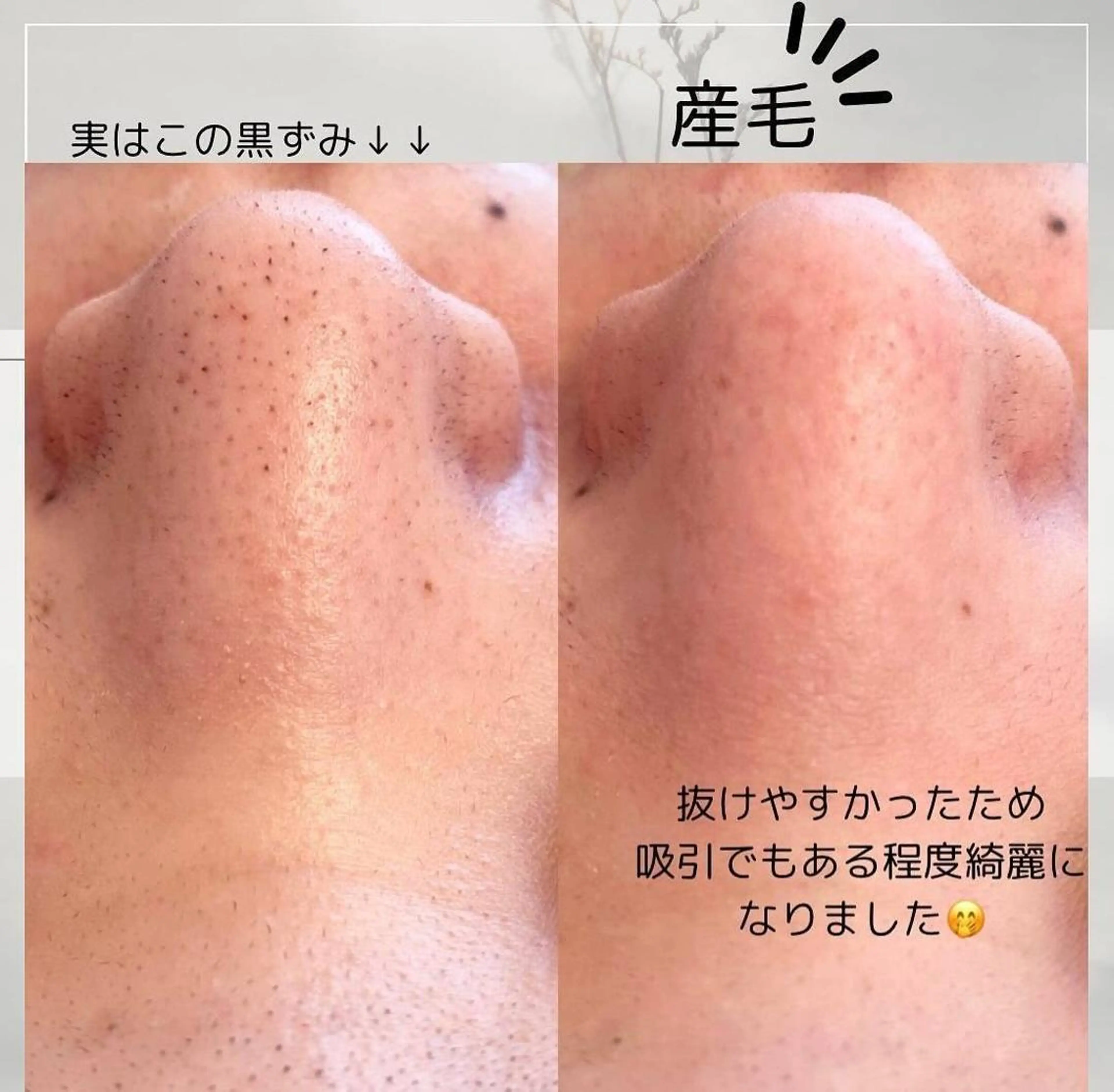 エステ 小林 理恵のエステ・リラクイメージ