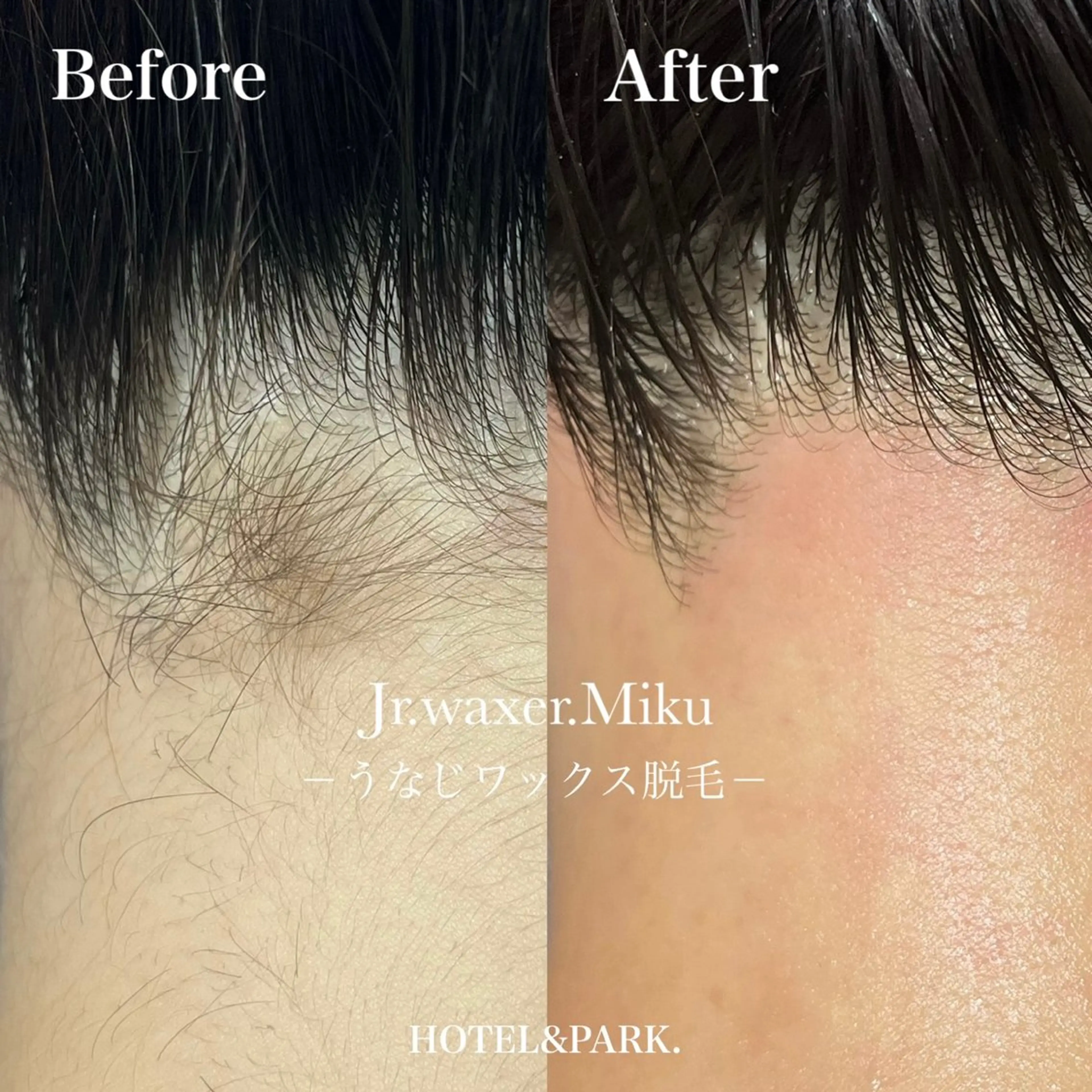 脱毛 HOTEL&PARK Mikuワックス脱毛のエステ・リラクイメージ