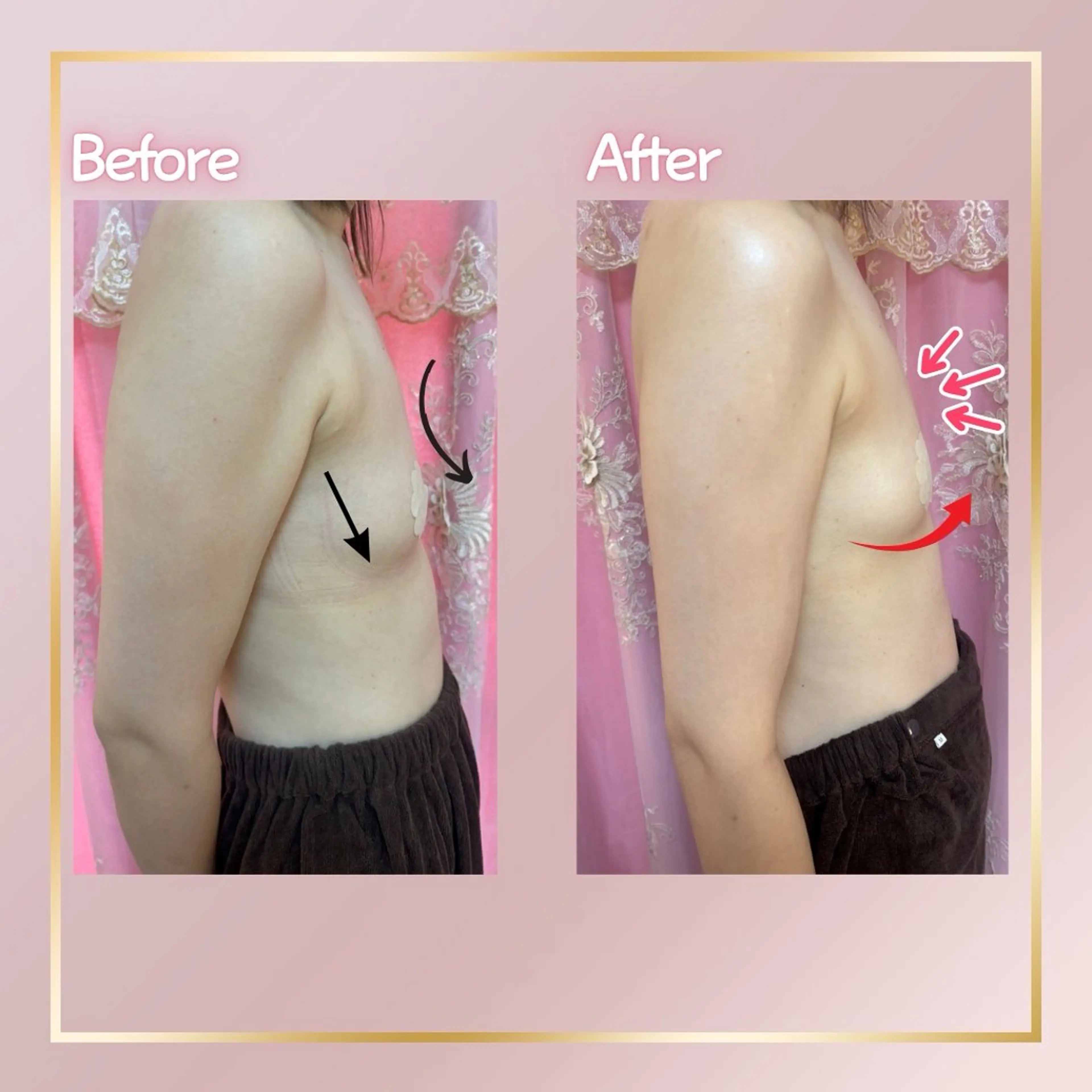 その他 ROSALIA 【バストアップ、痩身、毛穴洗浄】所属・ROSALIA バスト 小顔 毛穴のエステ・リラクイメージ