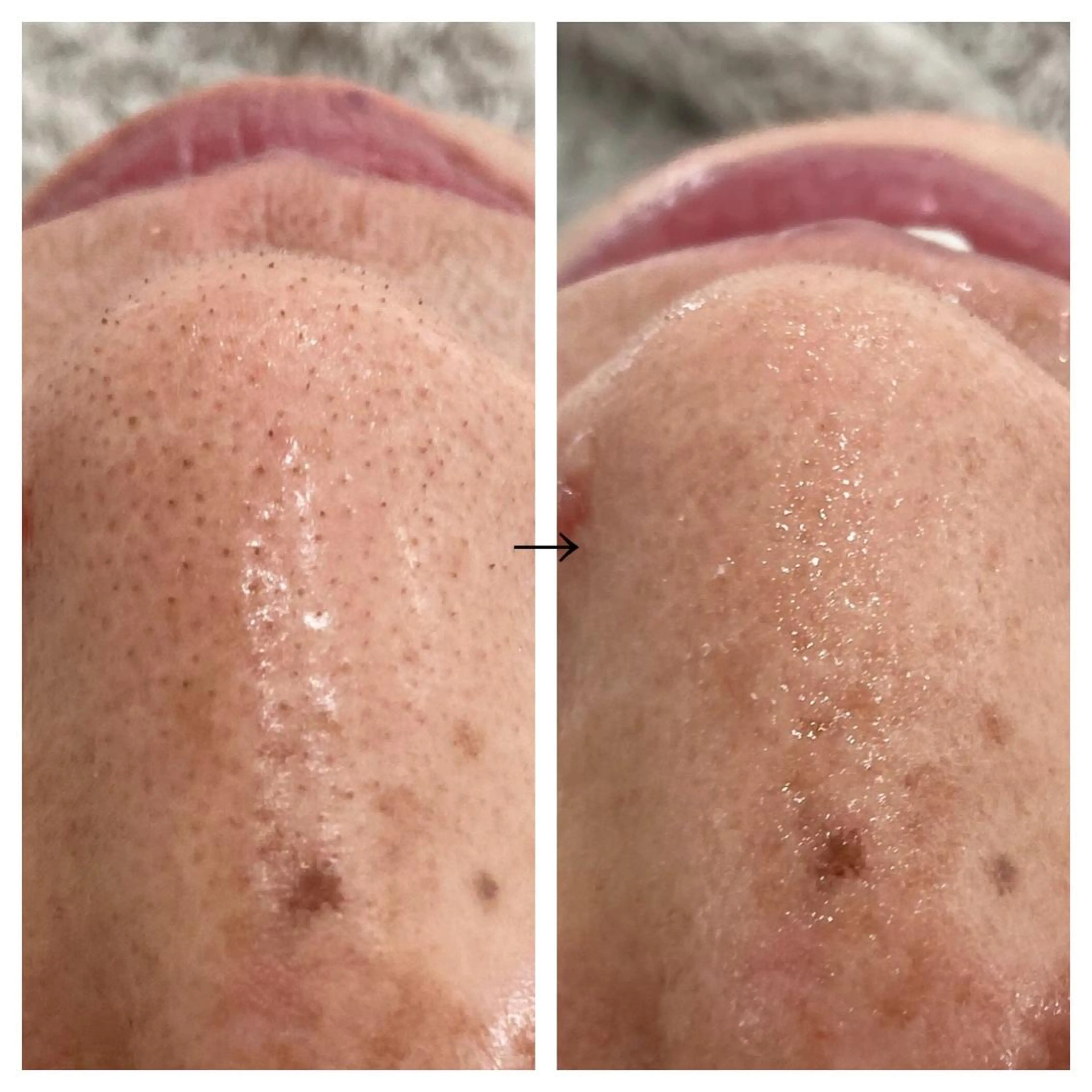 ビューティー ミロワールのエステ・リラクイメージ