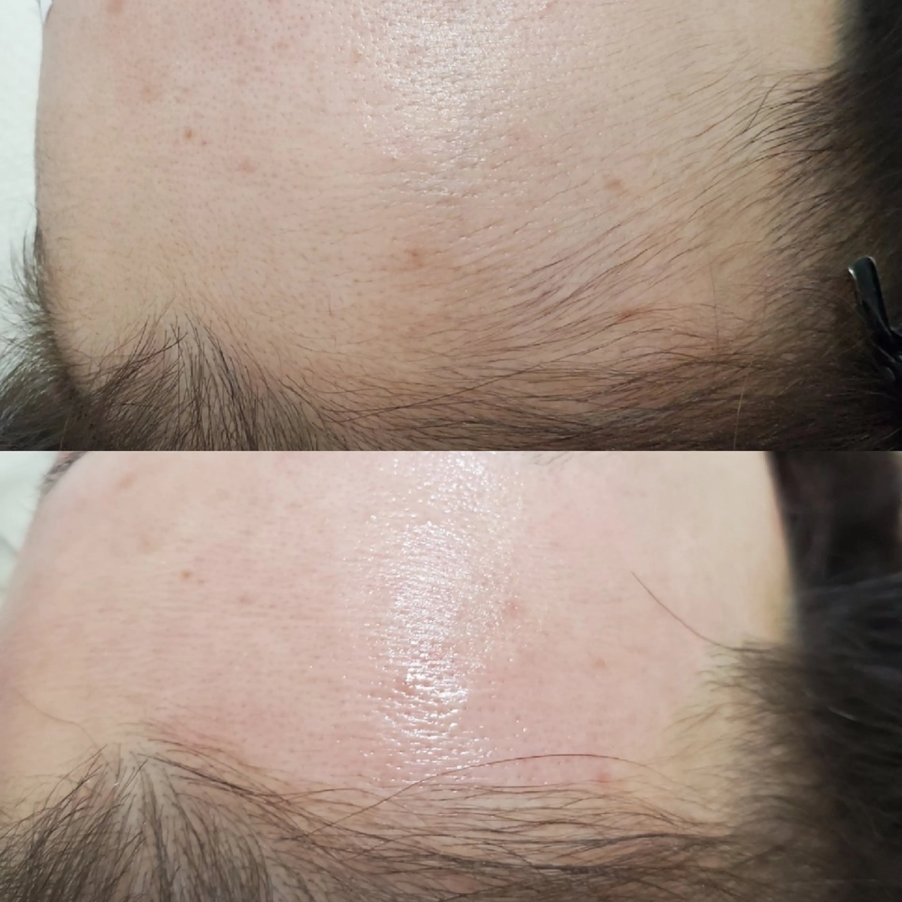 おでこWAX💆✨の写真