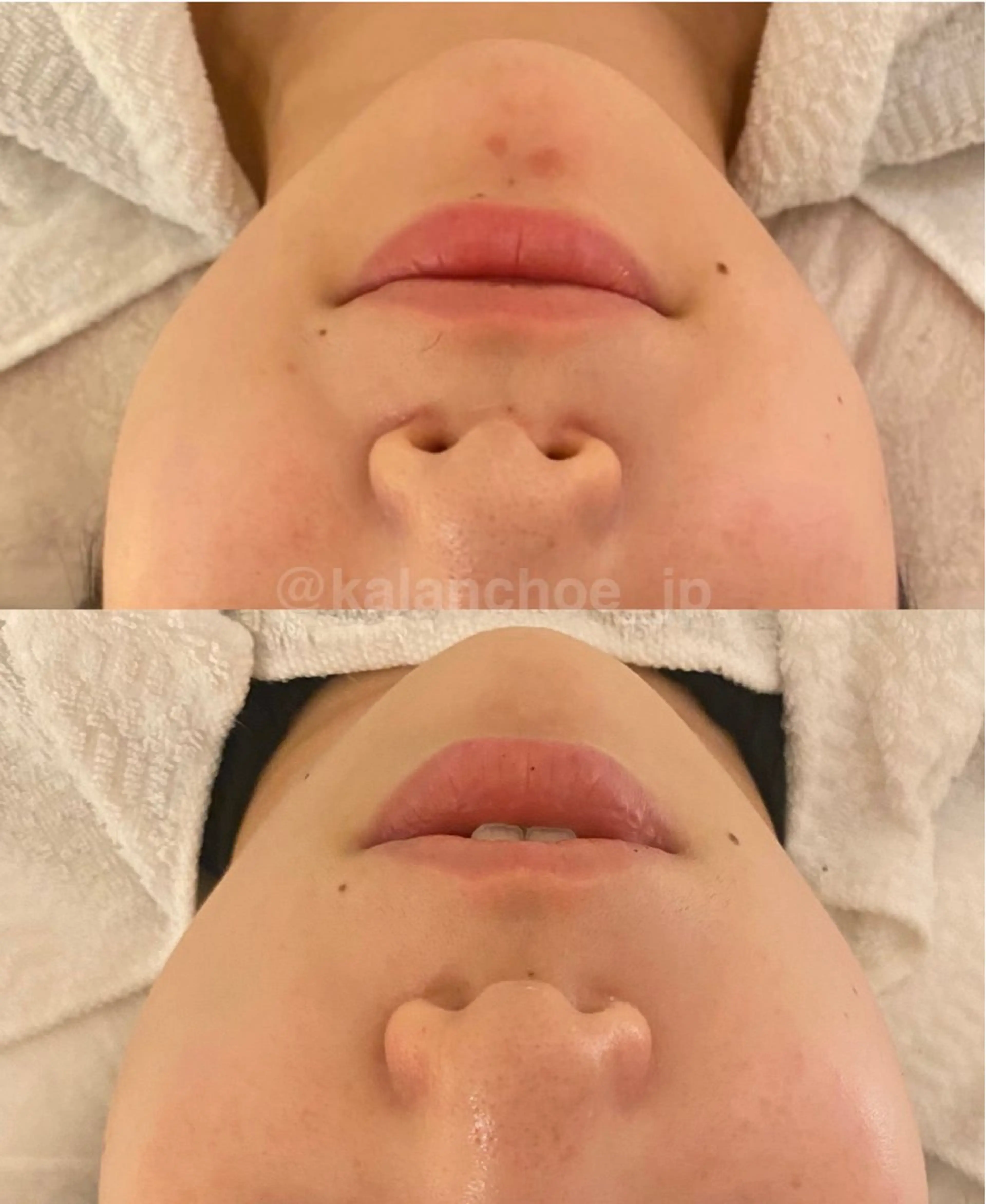 エステ 肌質改善 KALANCHOEのエステ・リラクイメージ