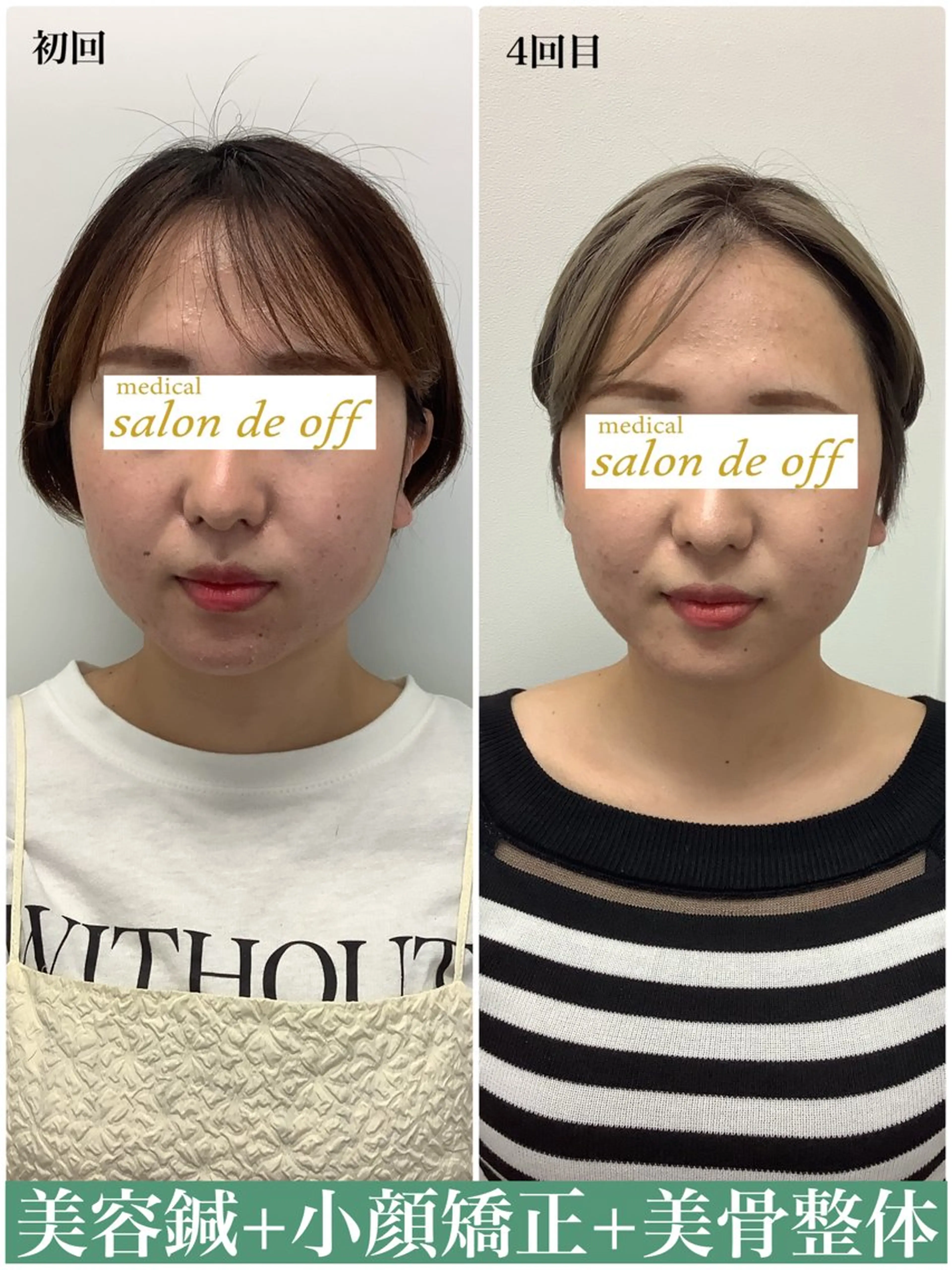 エステ リラク メディカルサロンドオフ所属・ハリサロンドオフ 美容鍼灸×小顔整体のエステ・リラクイメージ