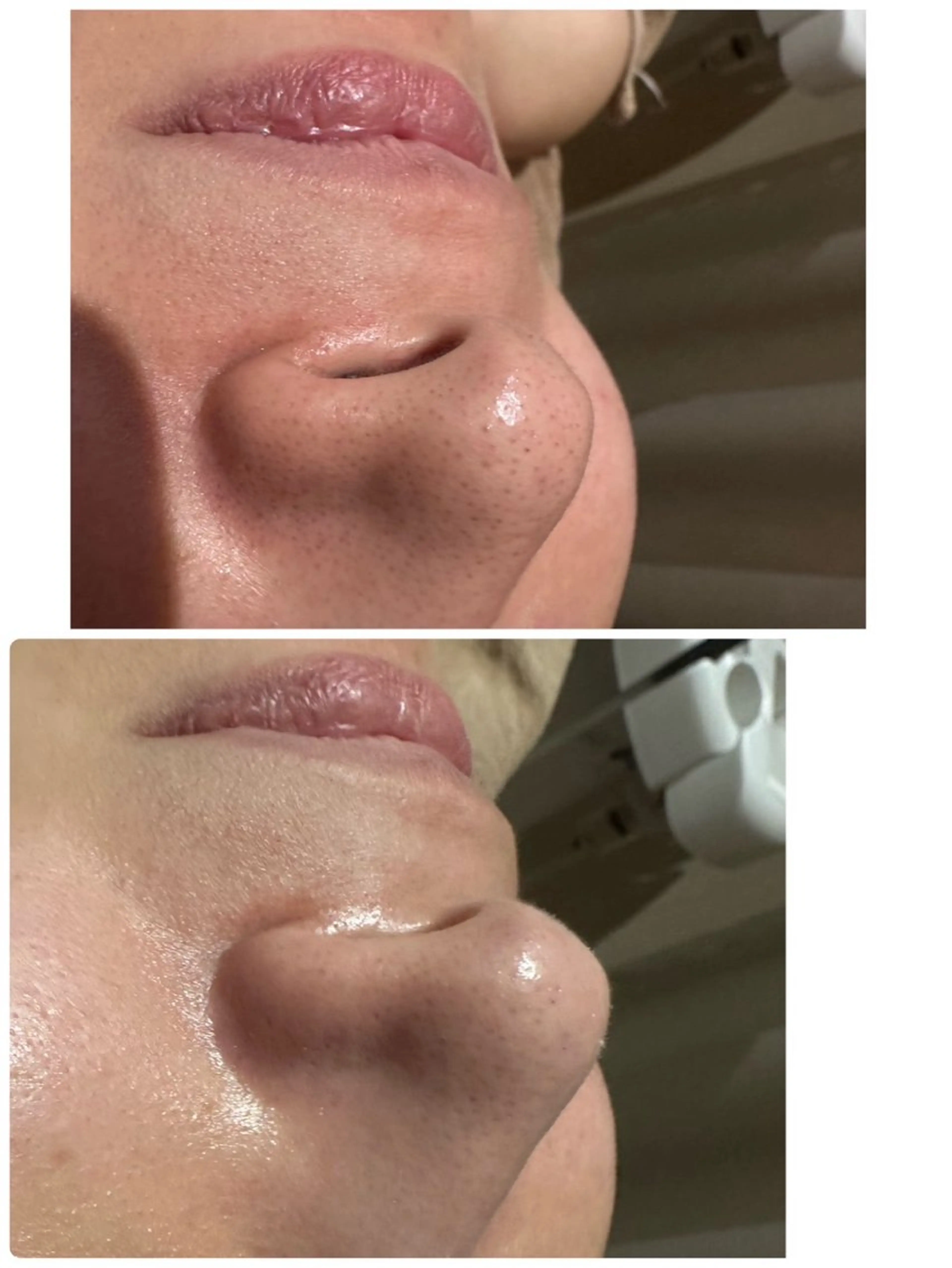 エステ 堀尾 あけみのエステ・リラクイメージ