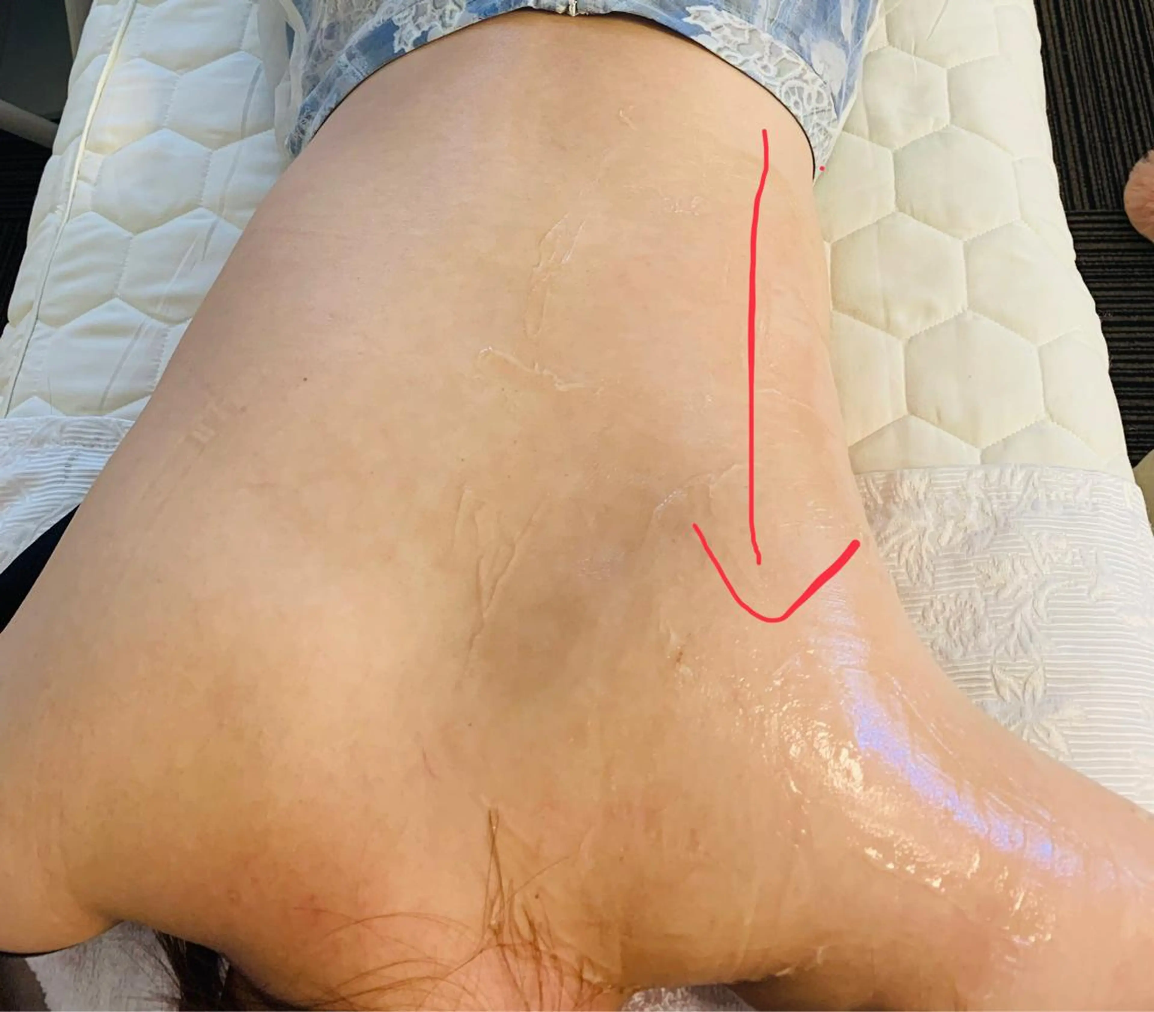 aliaハイフ&水光ジェットサロン所属・aliaハーブ水光店 エステティシャン募集のエステ・リラクイメージ