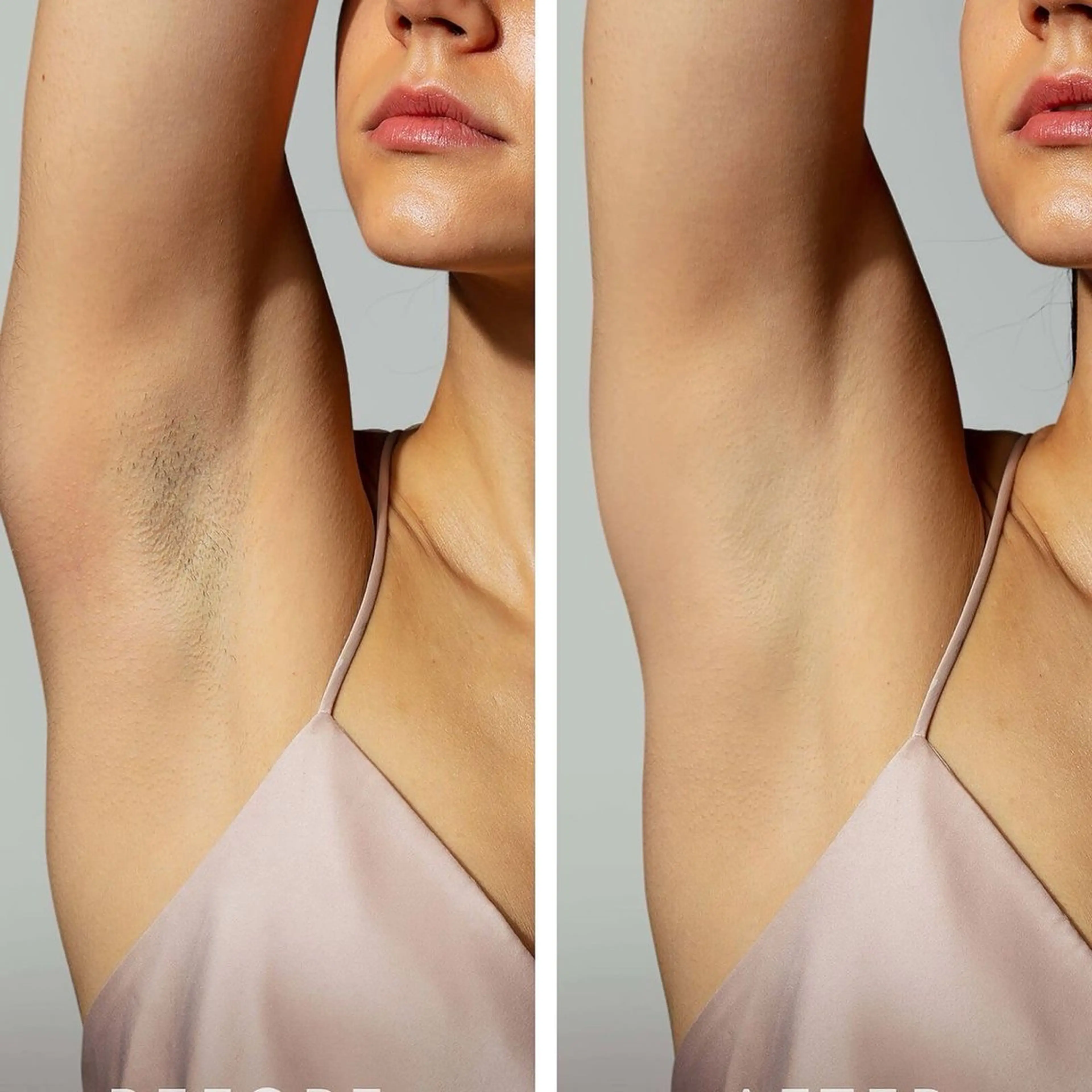 脱毛 サルバトーレ所属・美容脱毛サロン なんば/namiのエステ・リラクイメージ