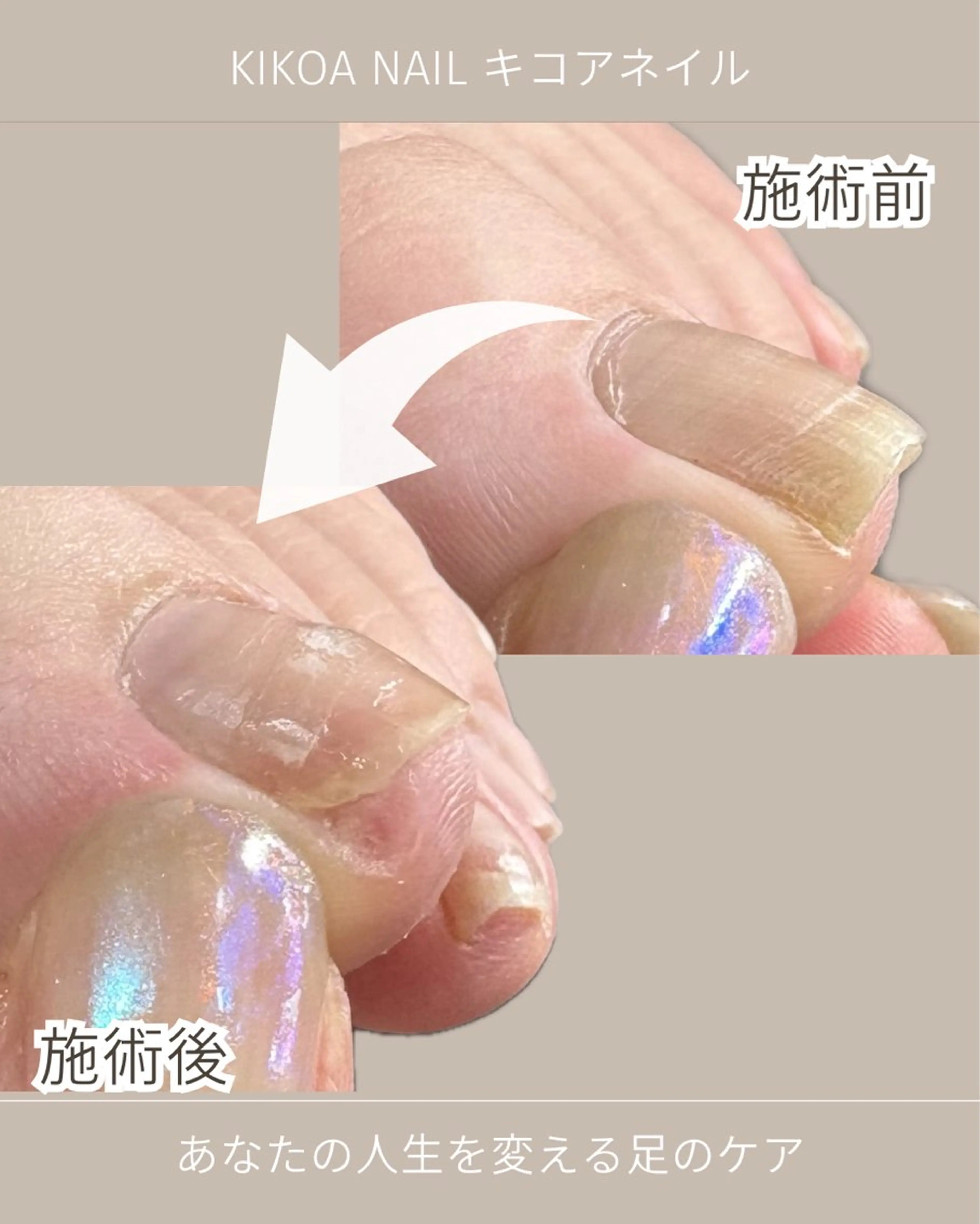 ネイル フットネイル KIKOA NAIL キコアネイルのネイルデザイン