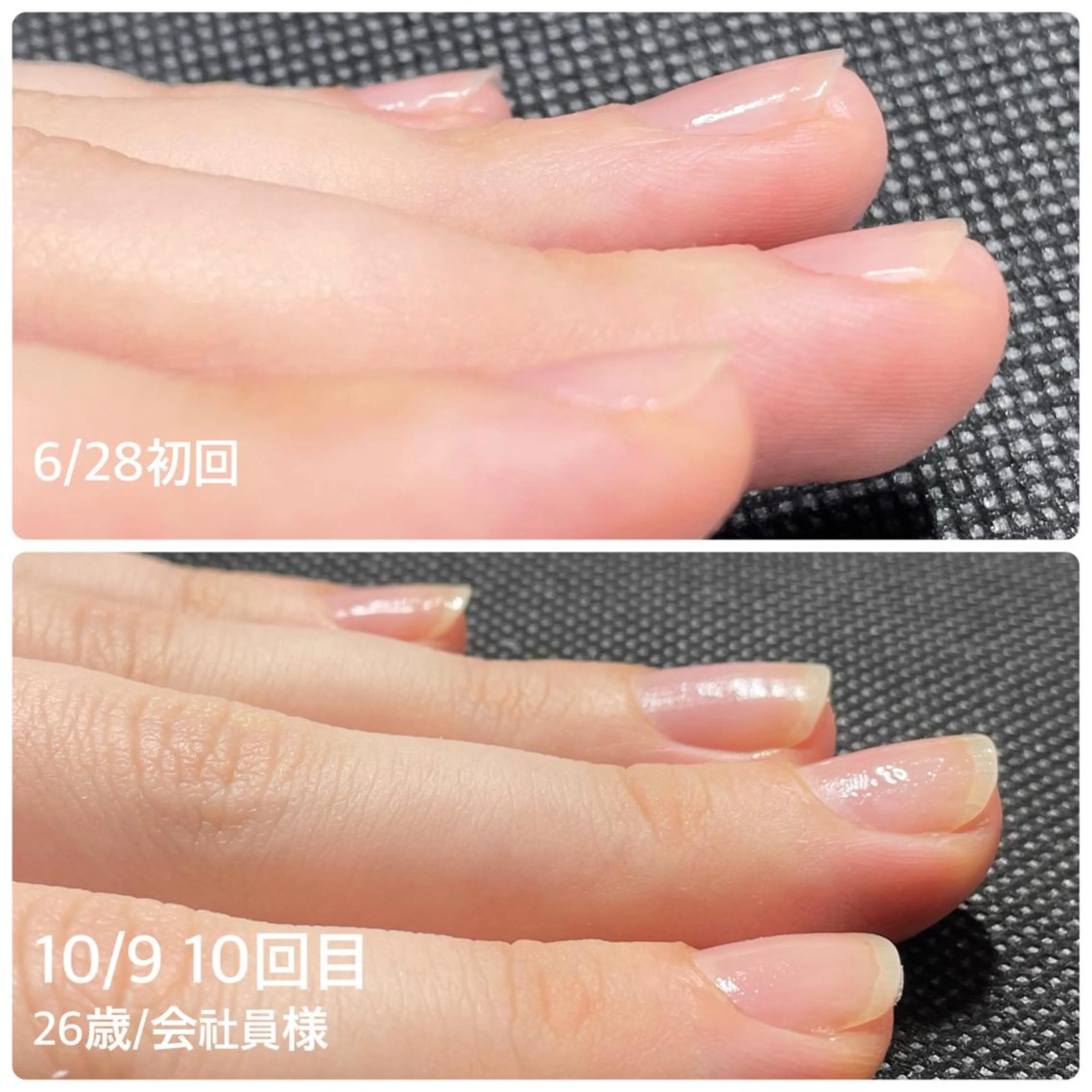 ネイル 奥園 良恵のネイルデザイン