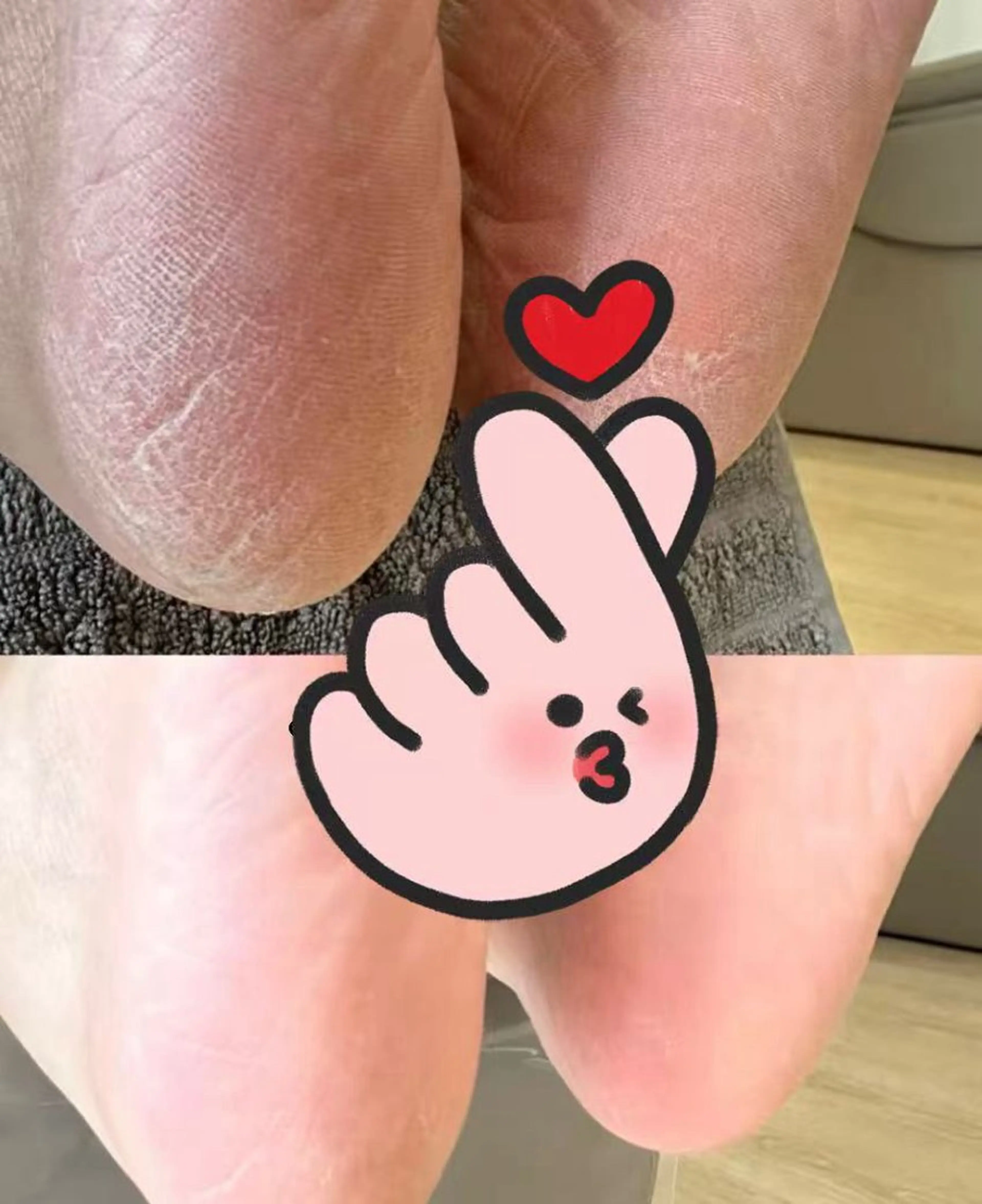 フットケアの写真