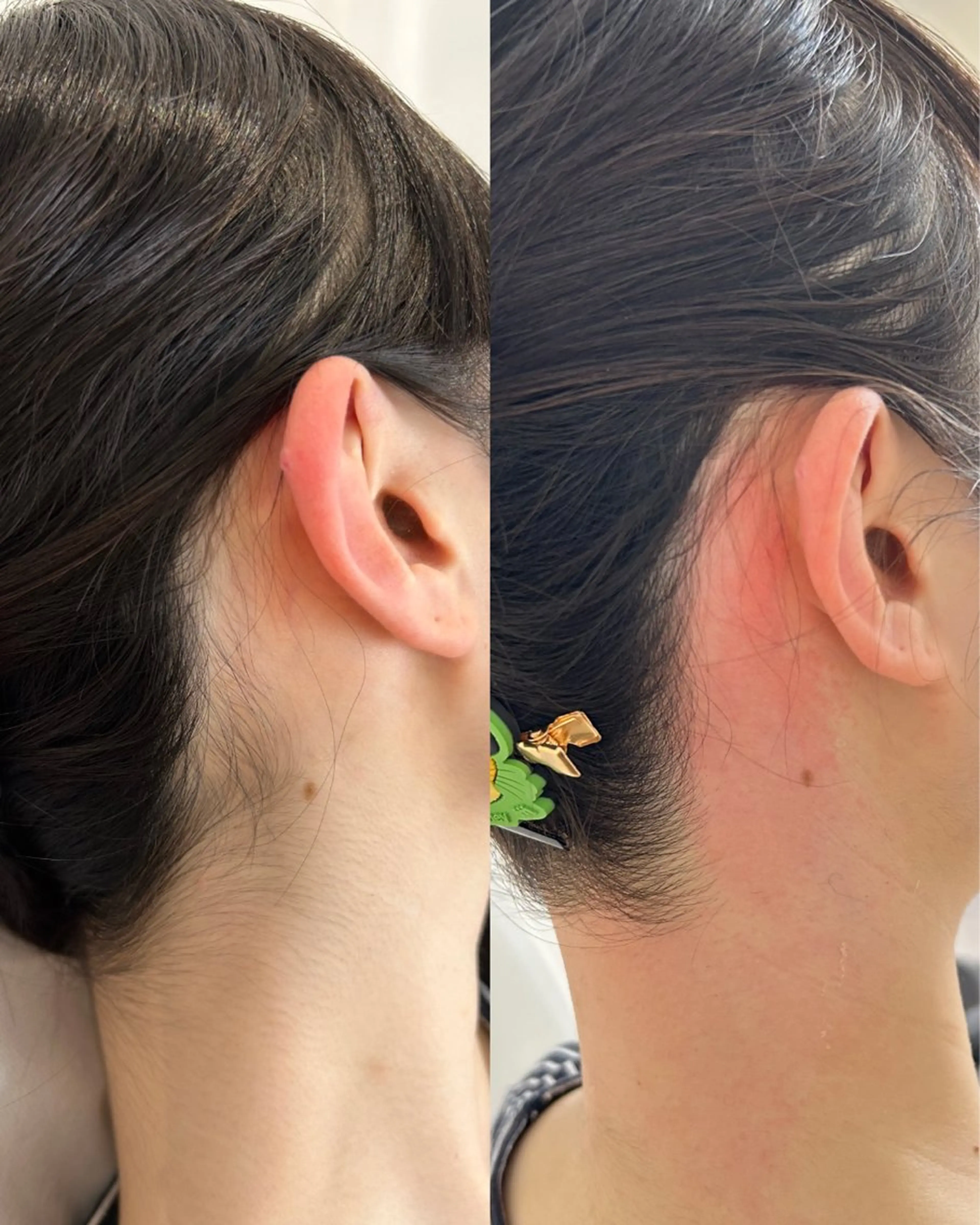 🥨6・7・8月限定価格🥨うなじ&もみあげWAX🦋✨　浴衣・アップスタイル・summer SET💡✨の写真