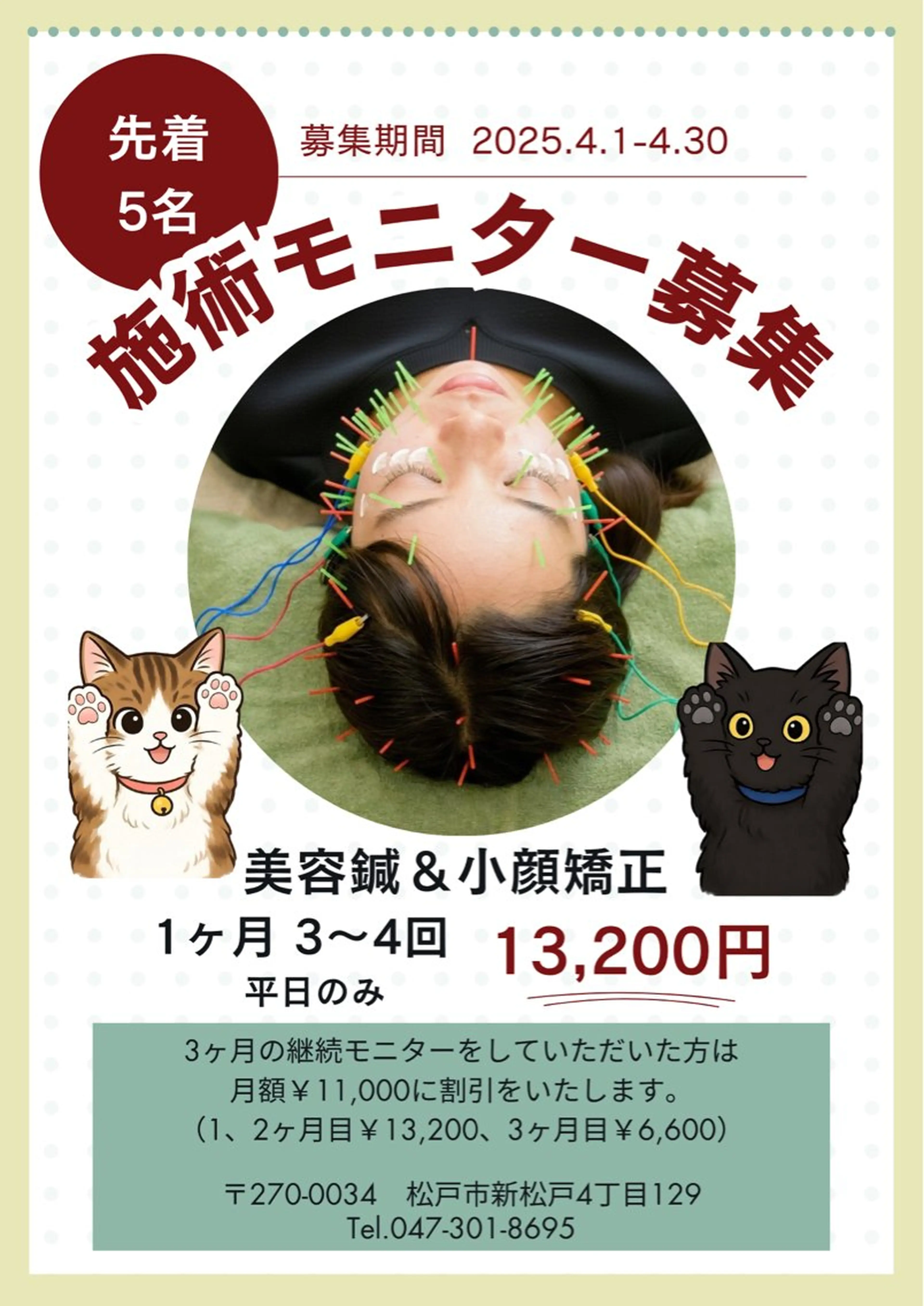 美容鍼+小顔矯正モニター　月3​〜​4回の施術でのお値段！の写真