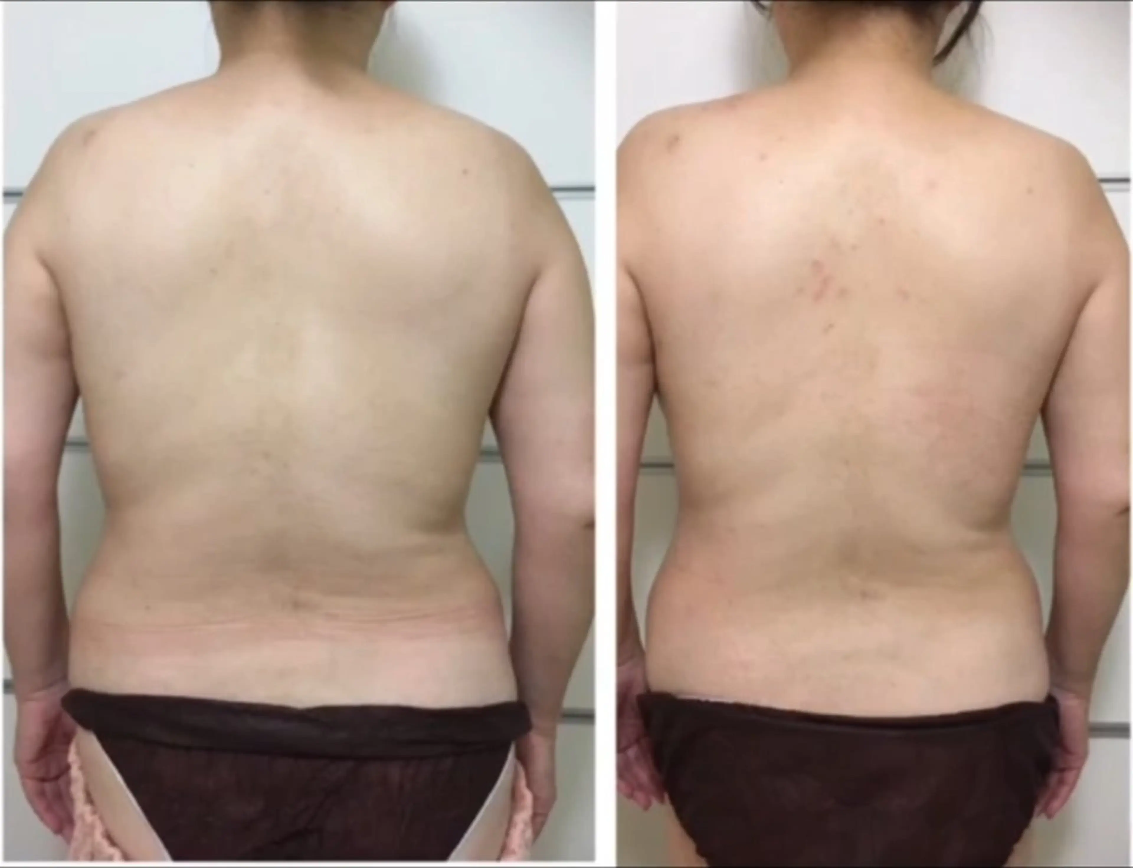 ヤマダ アキナのエステ・リラクイメージ