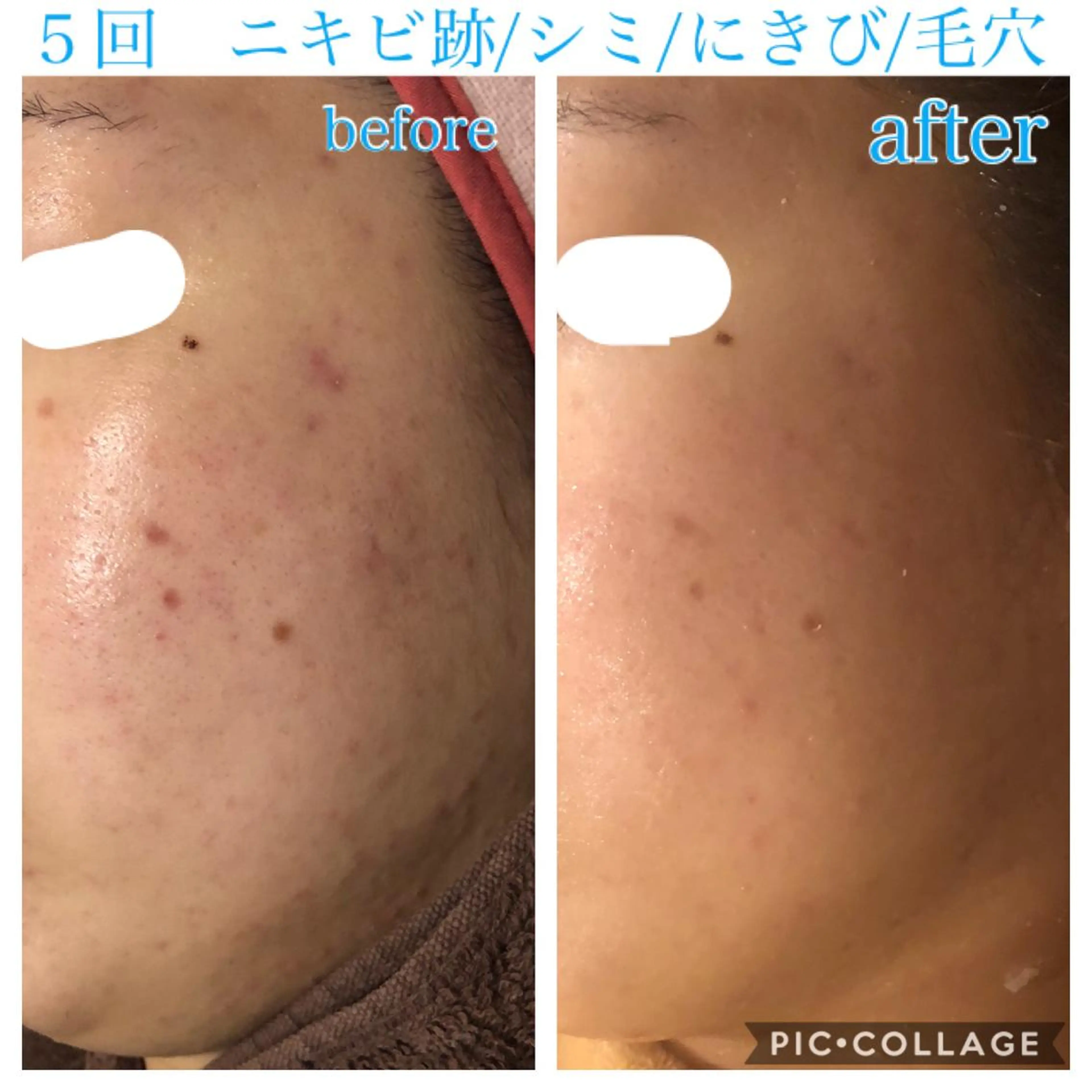 ショート カラー パーマ ヘアアレンジ メンズ キッズ ネイル マツエク・マツパ エステ リラク Ensor Clair所属・EnsorClair 代表　野口真央のエステ・リラクイメージ