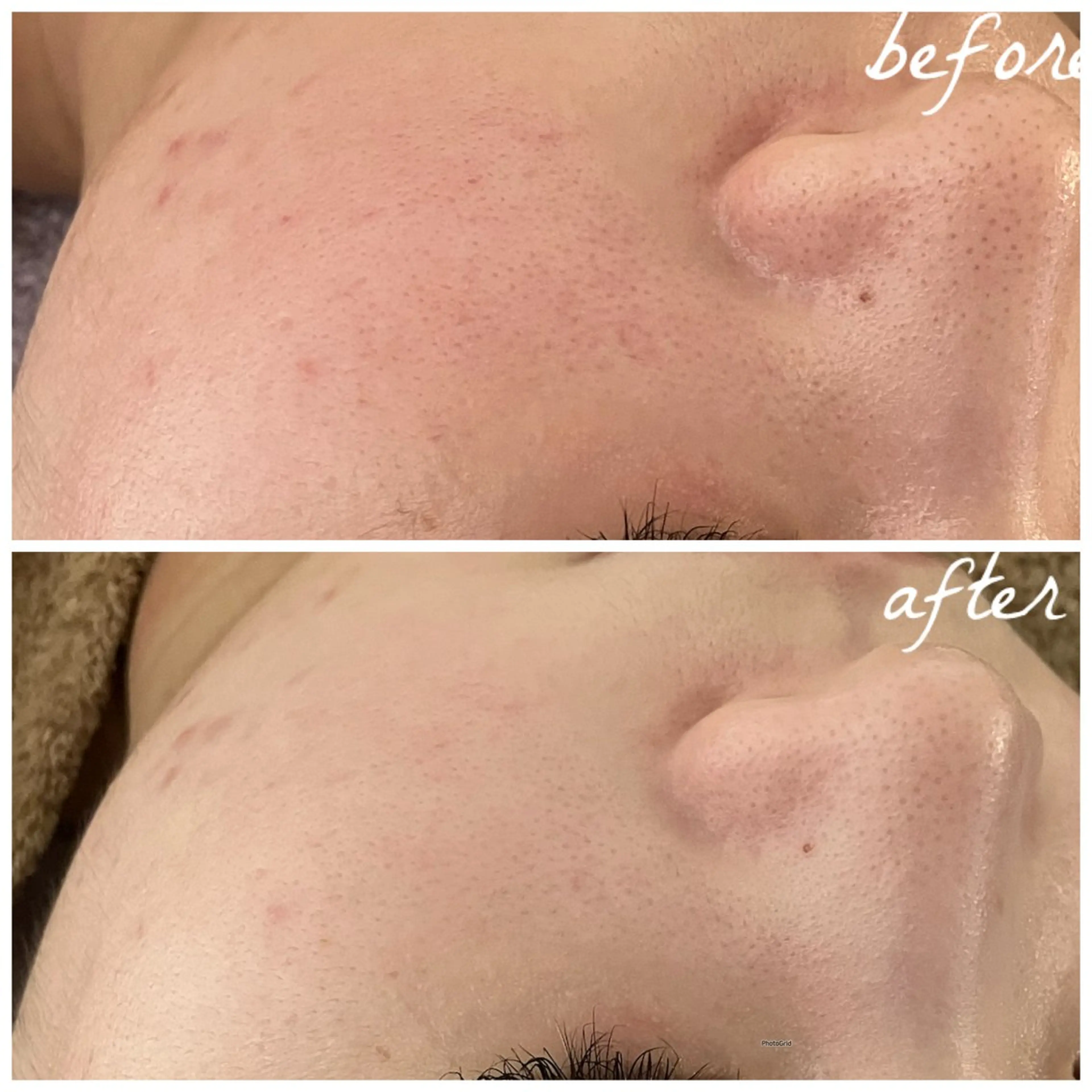 メンズ エステ メナード岐阜茜部 杉浦のエステ・リラクイメージ