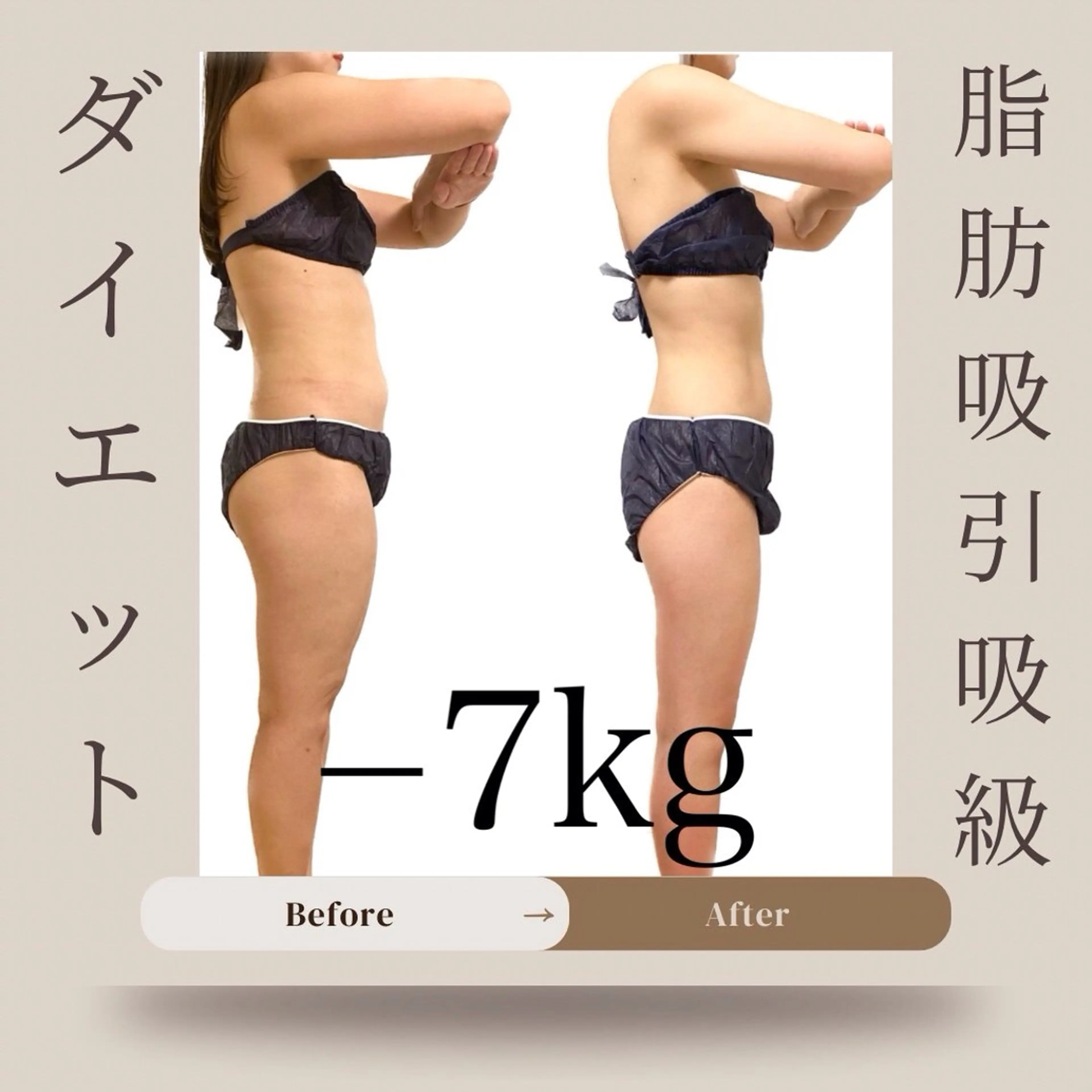 気になる所は全部です！と言うあなた😳【本気全身痩せ】90分¥11000の写真