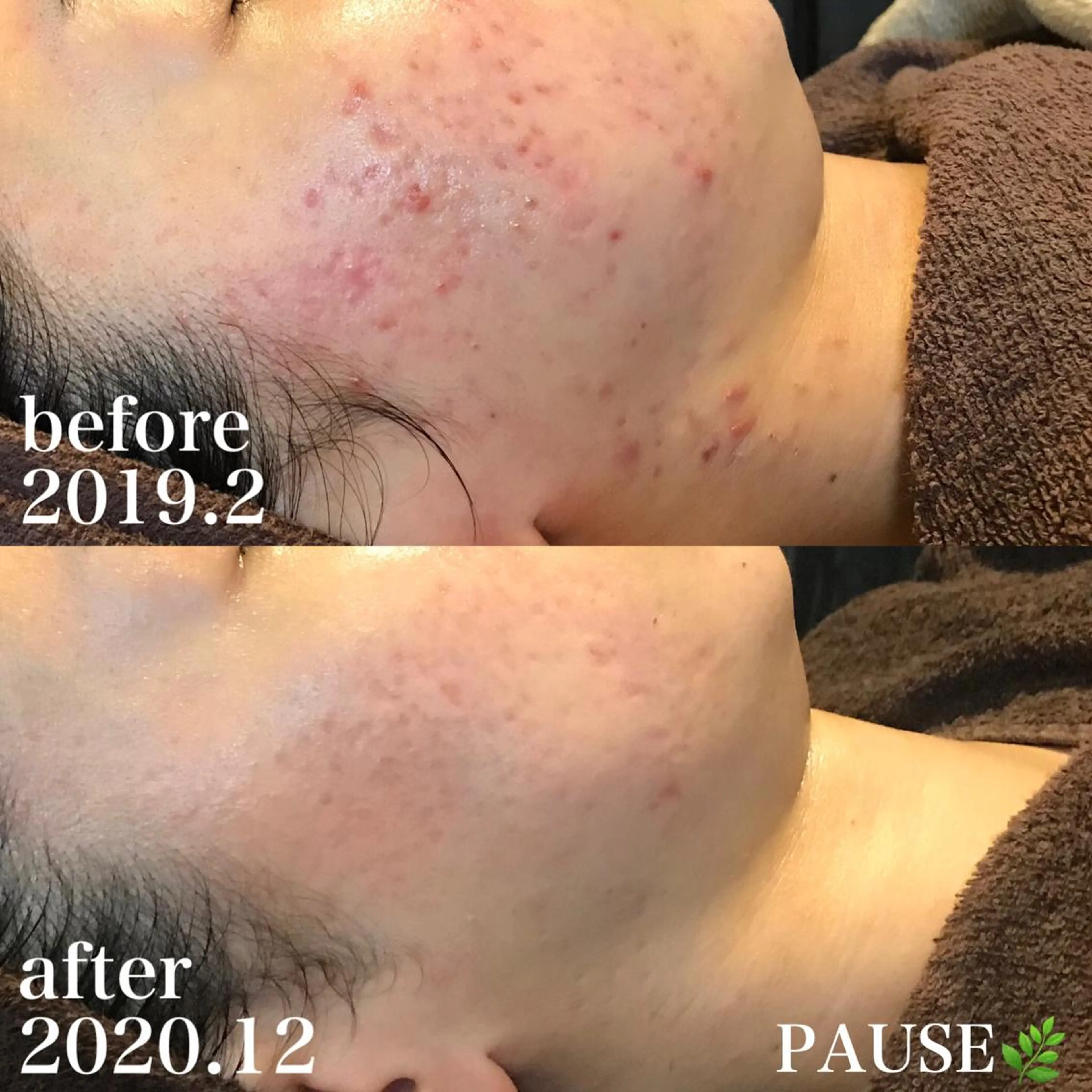 エステ 浜野 恵美のエステ・リラクイメージ