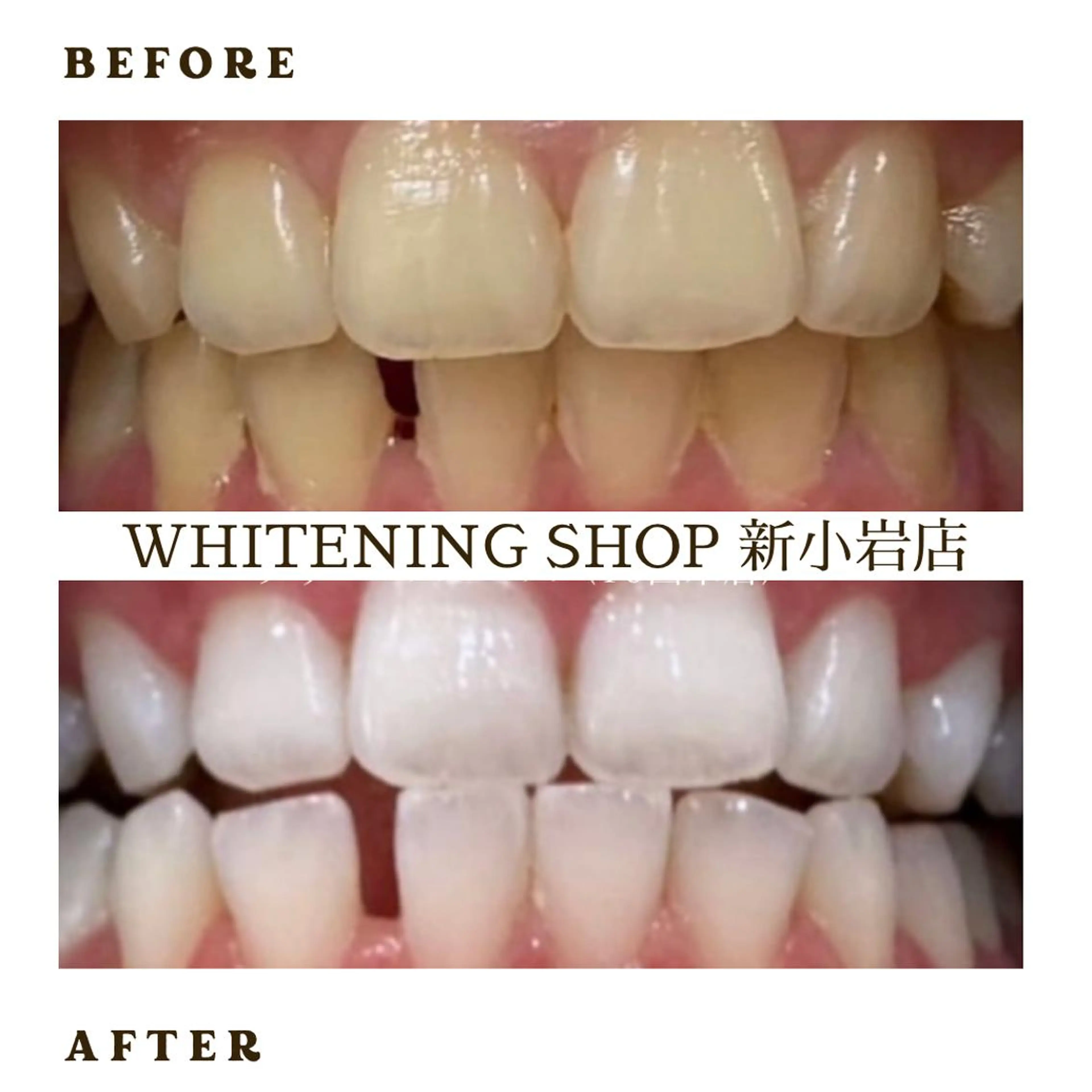 メンズ その他 ホワイトニング ショップ新小岩店のその他イメージ