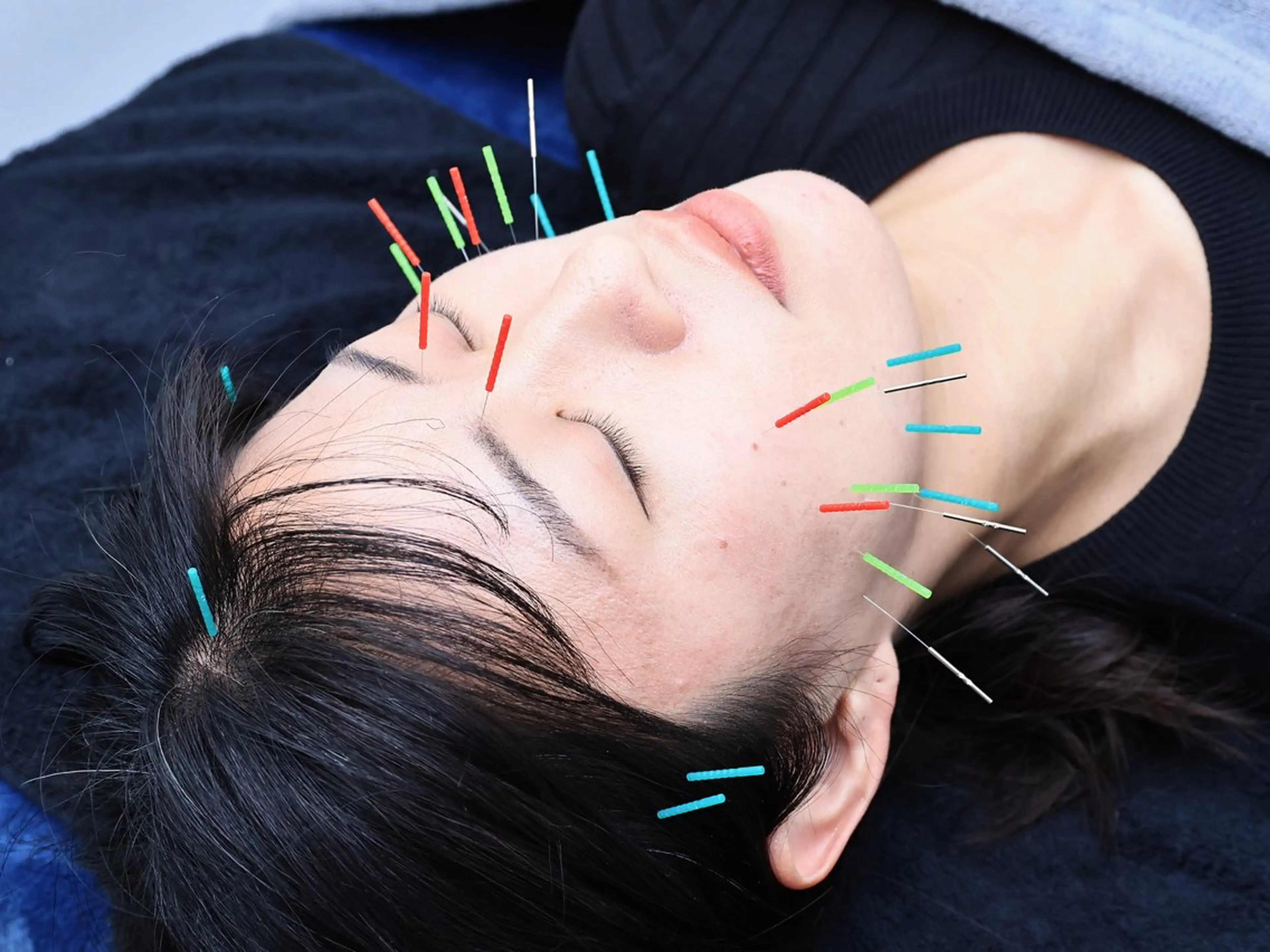 美容鍼・小顔矯正 FLOW 鍼灸整体院のその他イメージ