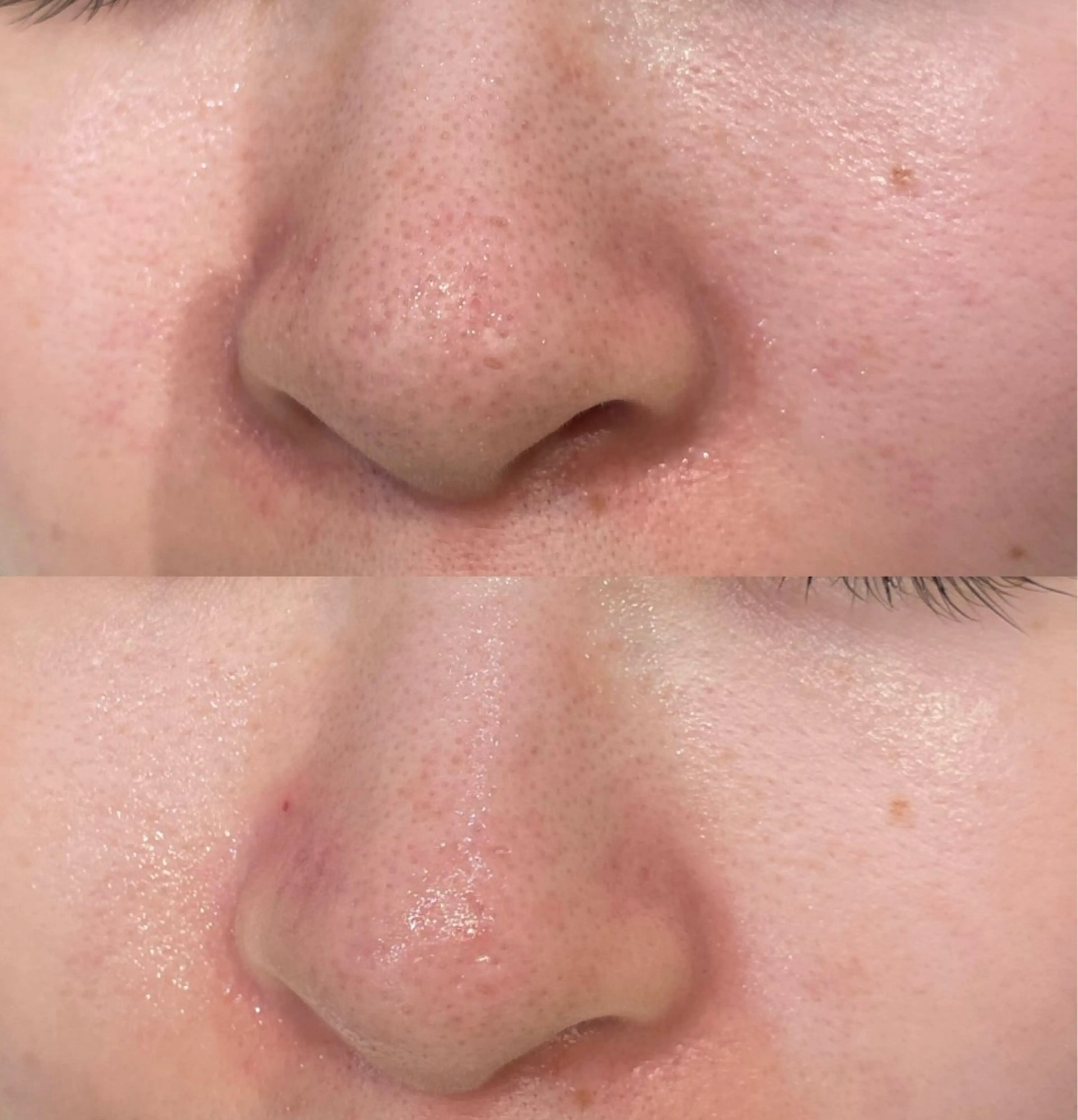 DeI'm   名古屋栄所属・小林 玲菜のエステ・リラクイメージ