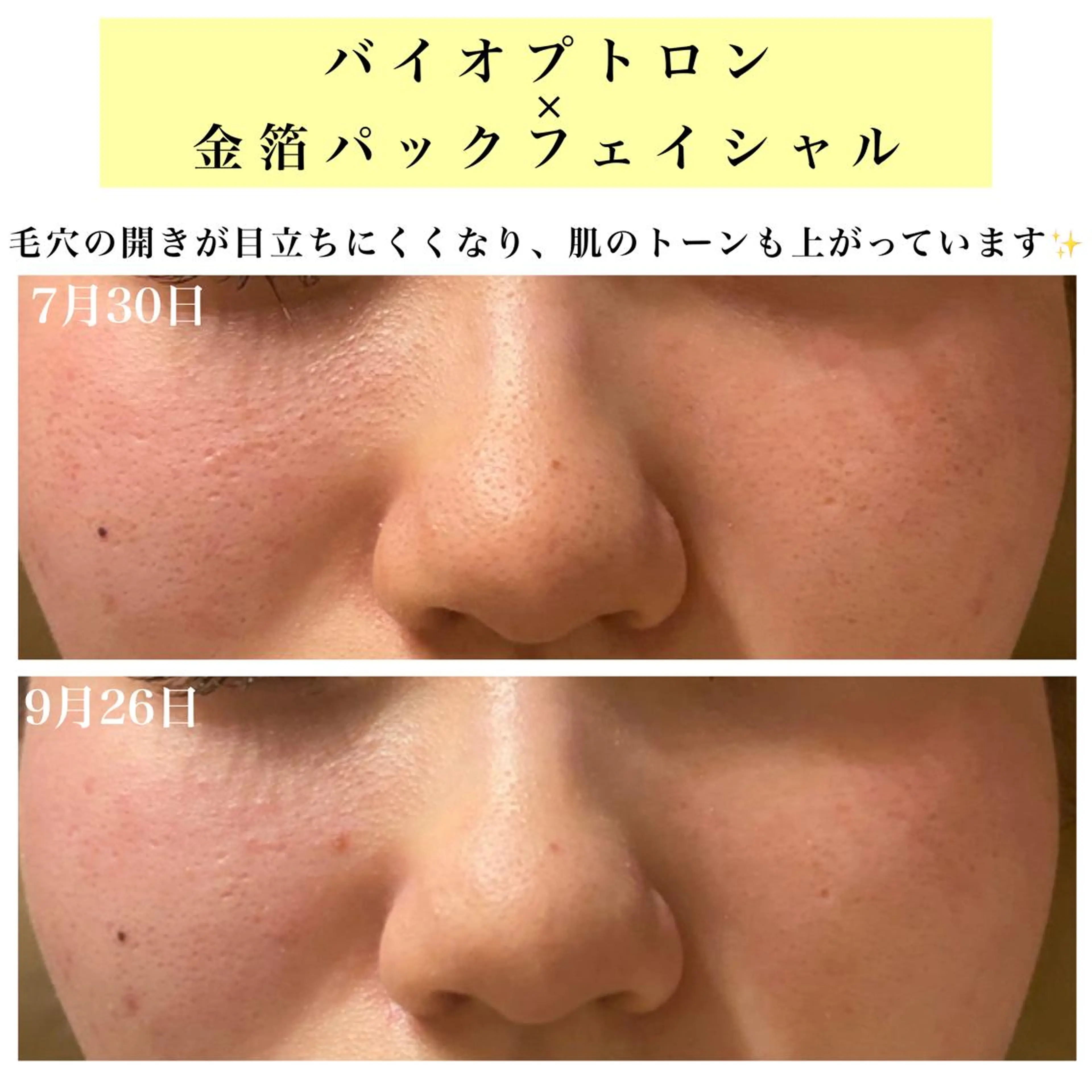 エステ リラク Bellesthe （ベルエステ）のエステ・リラクイメージ