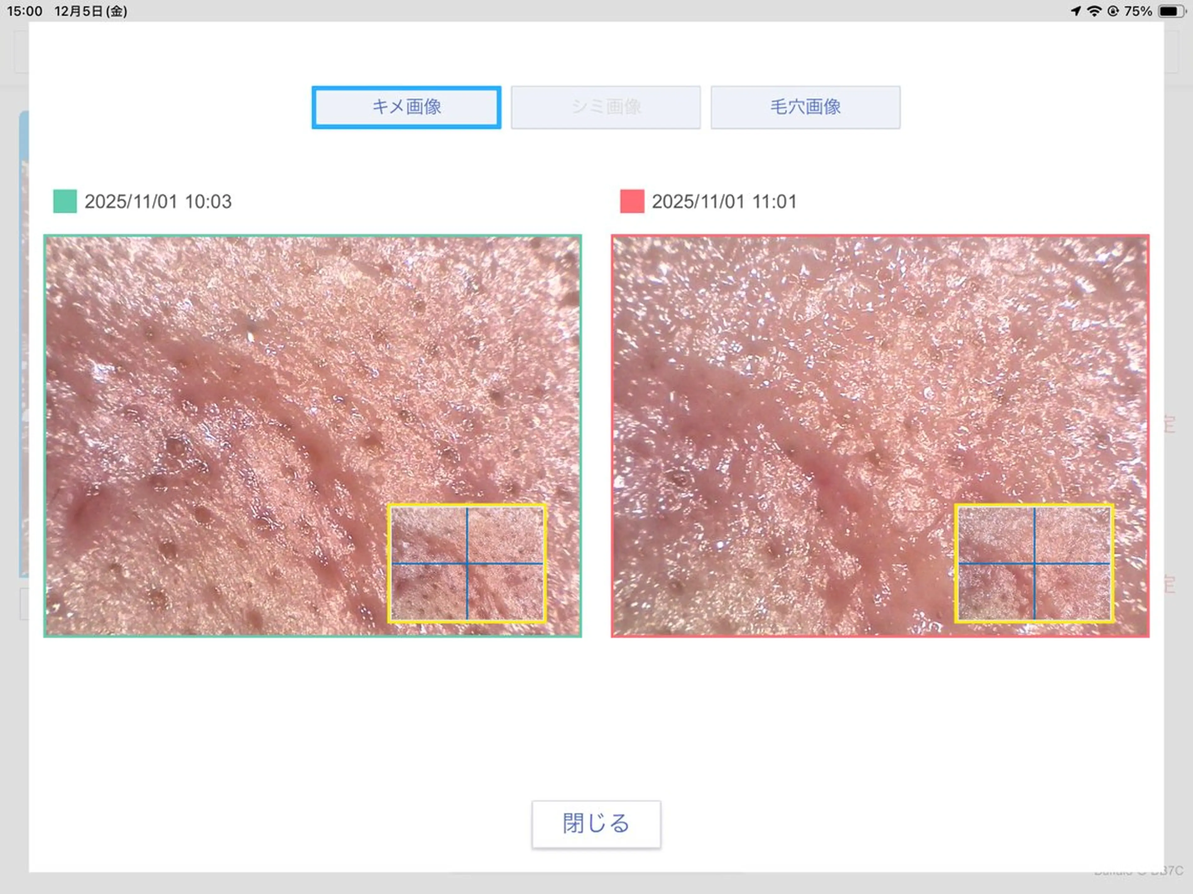 エステ 毛穴専門店Bébéもりの里店所属・毛穴専門店Bébé もりの里店のエステ・リラクイメージ