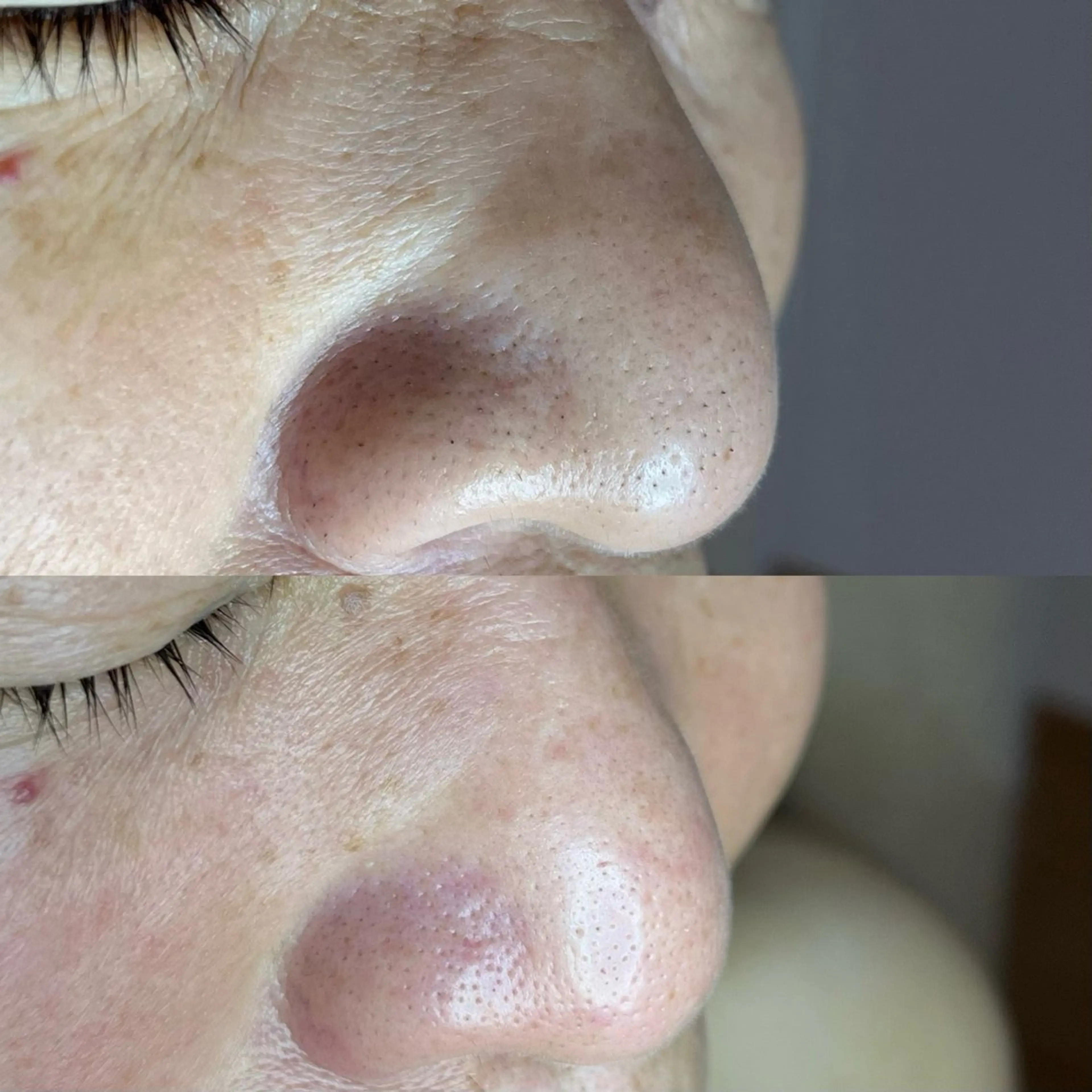 毛穴ケア・ヘッドスパサロンSHINY(シャイニー)所属・毛穴ケア・ヘッドスパ サロンSHINYのエステ・リラクイメージ