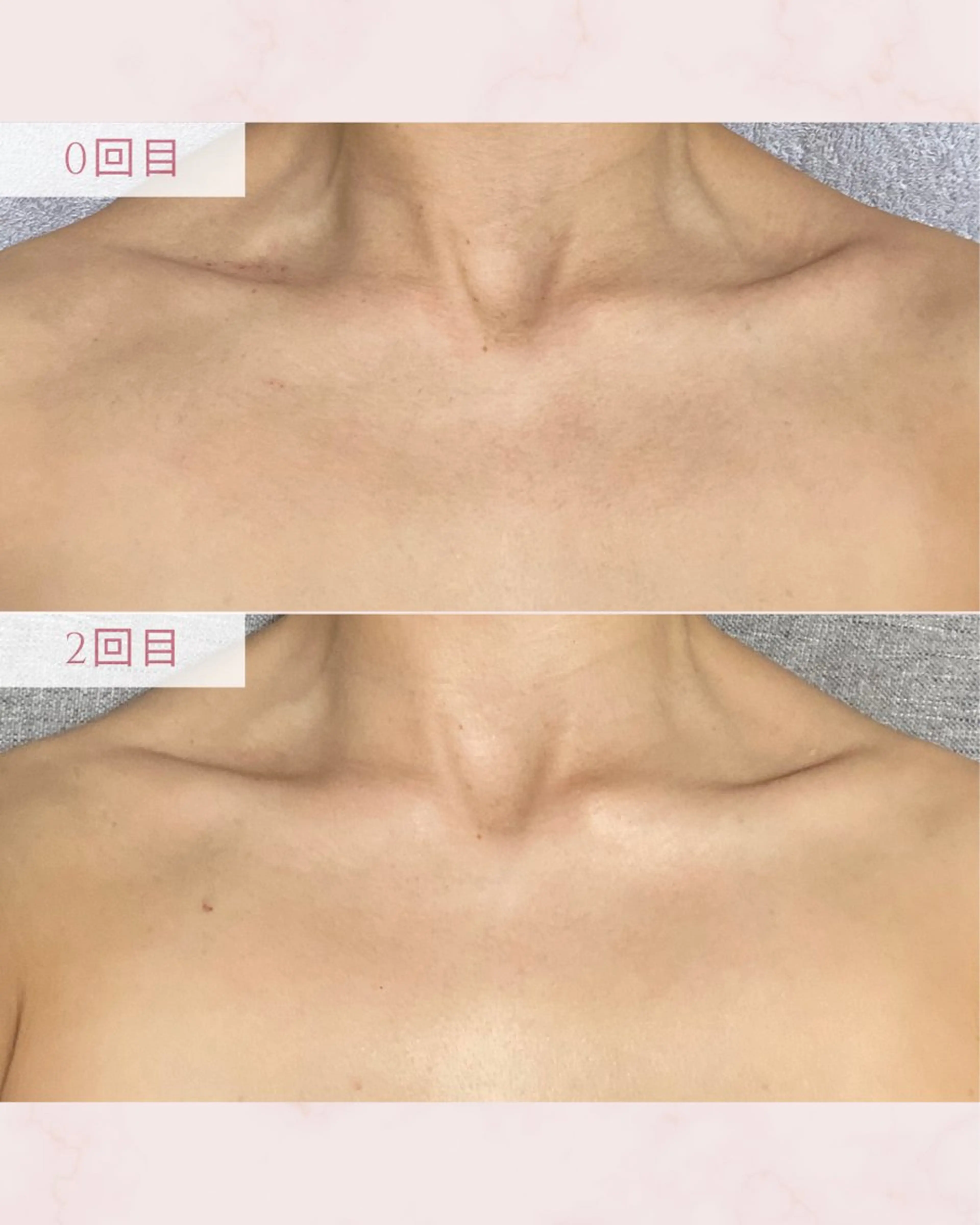 エステ MAUM-美 caresalon-のエステ・リラクイメージ