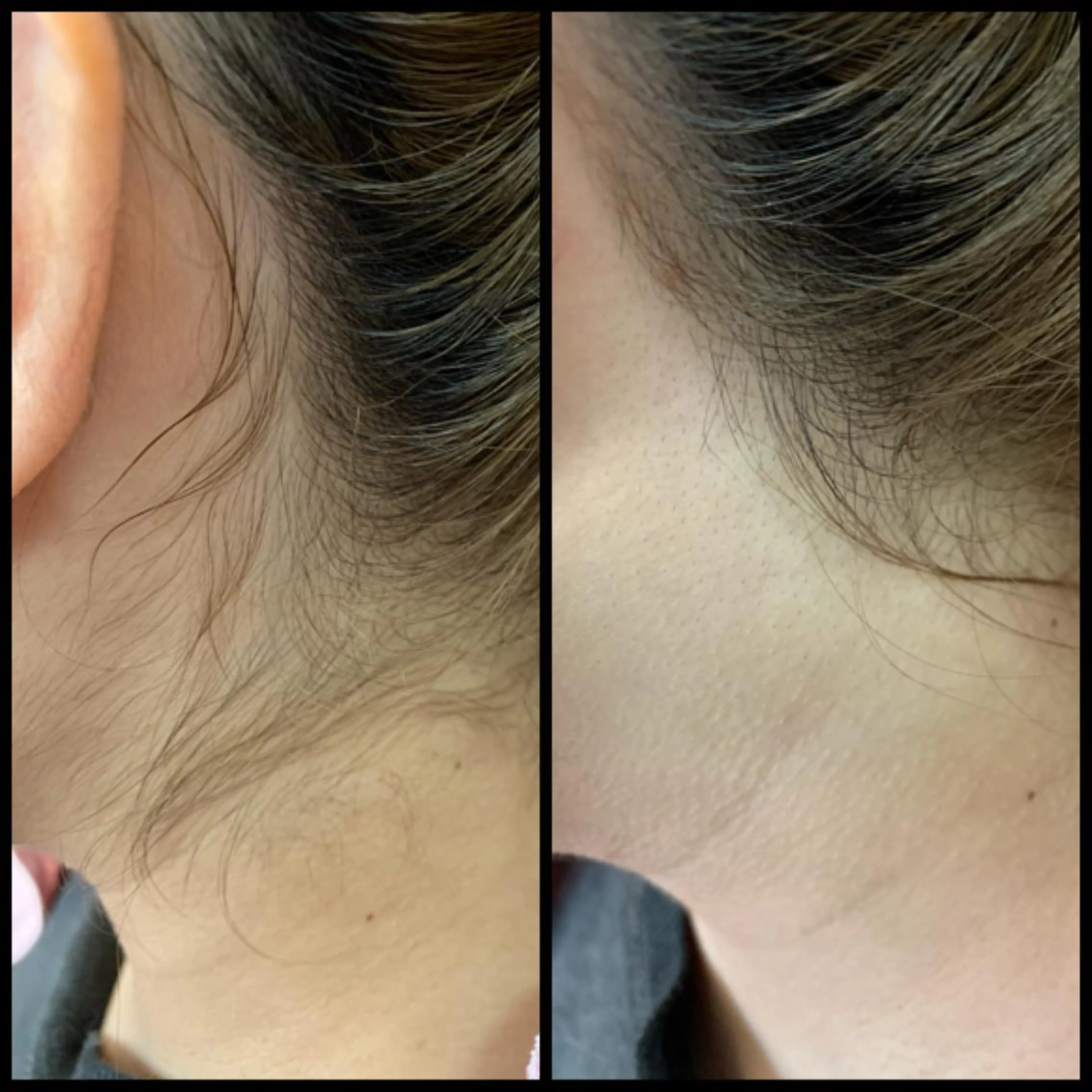 レディースシェービングサロンbijou所属・シェービングサロン bijouの眉毛・アイブロウイメージ